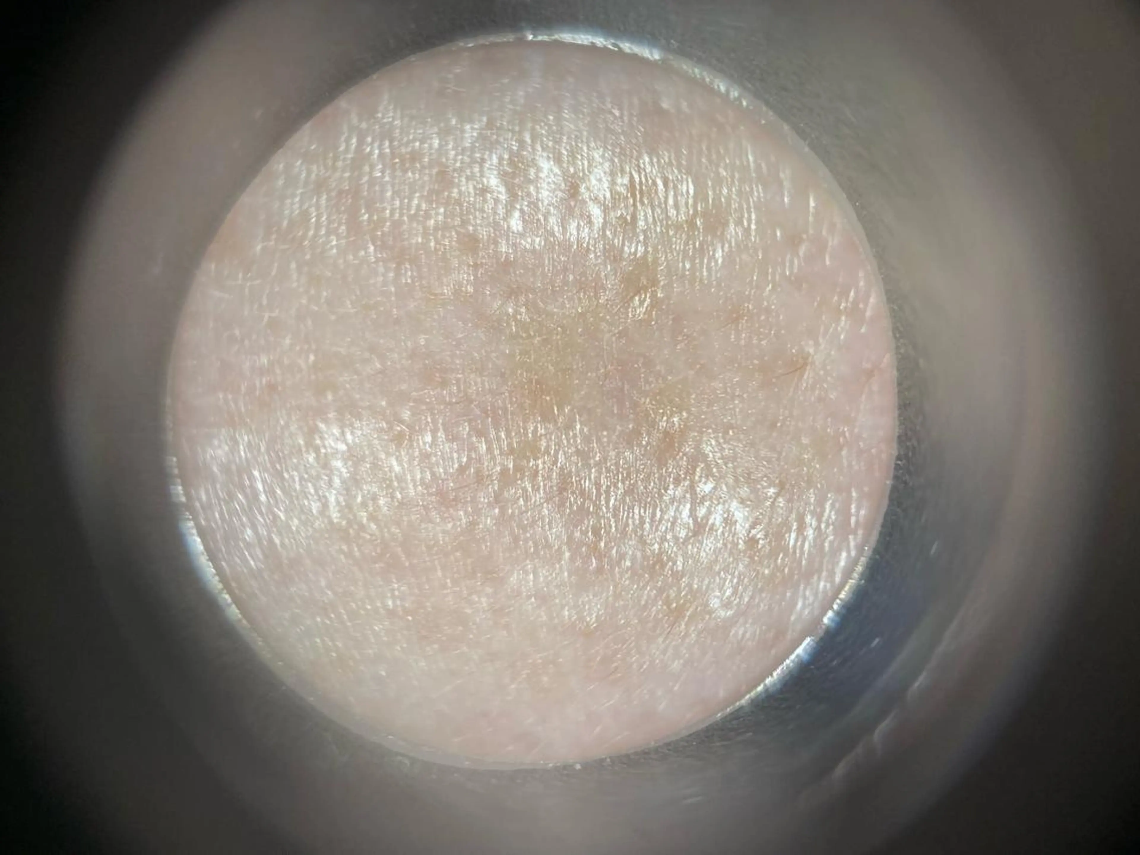 ミディアム マツエク・マツパ アイブロウ 小倉 麻由のエステ・リラクイメージ