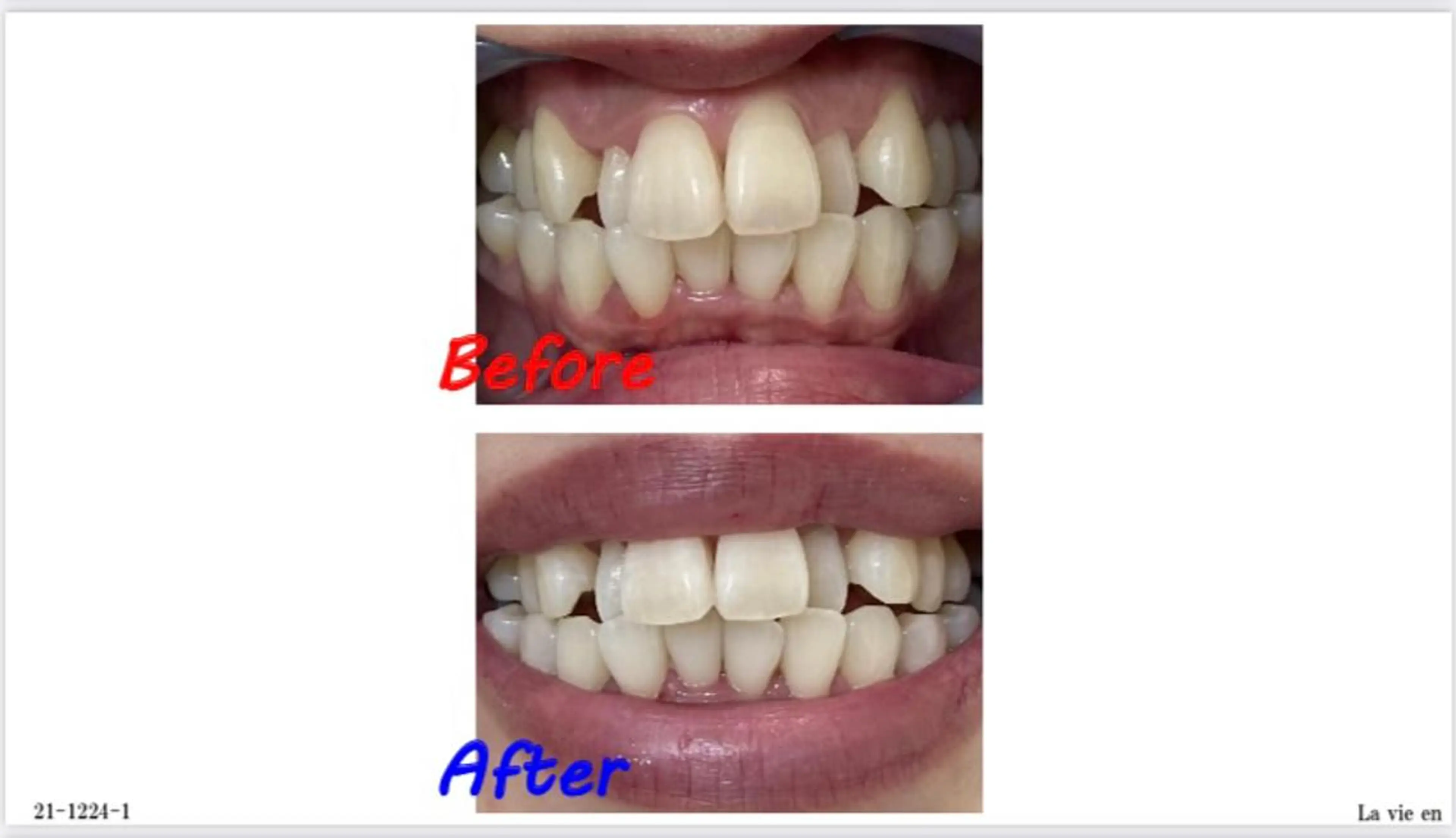 その他 セルフホワイトニングサロン　ラヴィアン所属・ホワイトニングサロン La vie enのその他イメージ