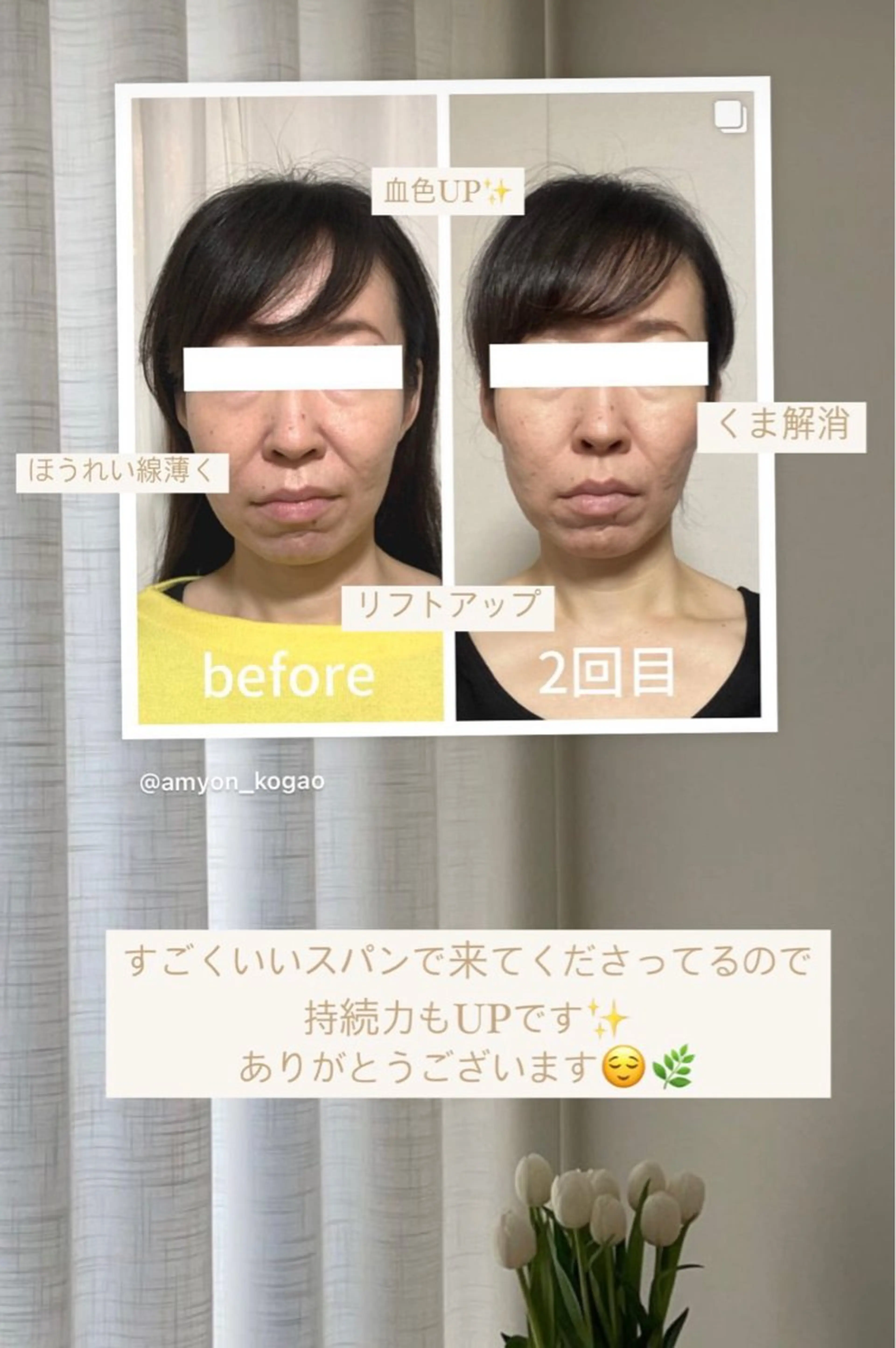 小顔サロン AMYONのエステ・リラクイメージ