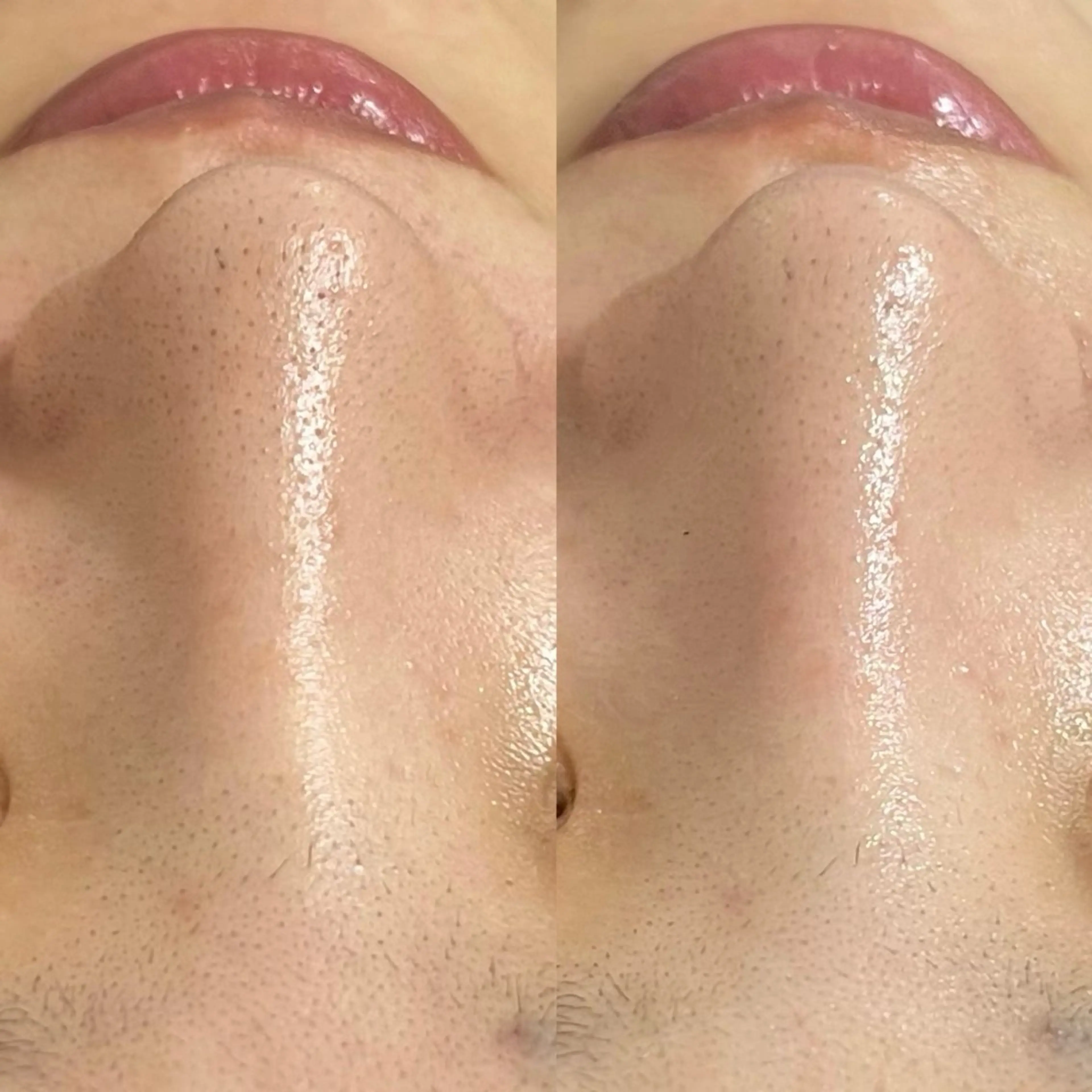 エステ 𝐌𝐚𝐜𝐡𝐞 𝐛𝐲 𝐌𝐚𝐲𝐮所属・ハーブピーリング🌿 𝑴𝒂𝒚𝒖のエステ・リラクイメージ