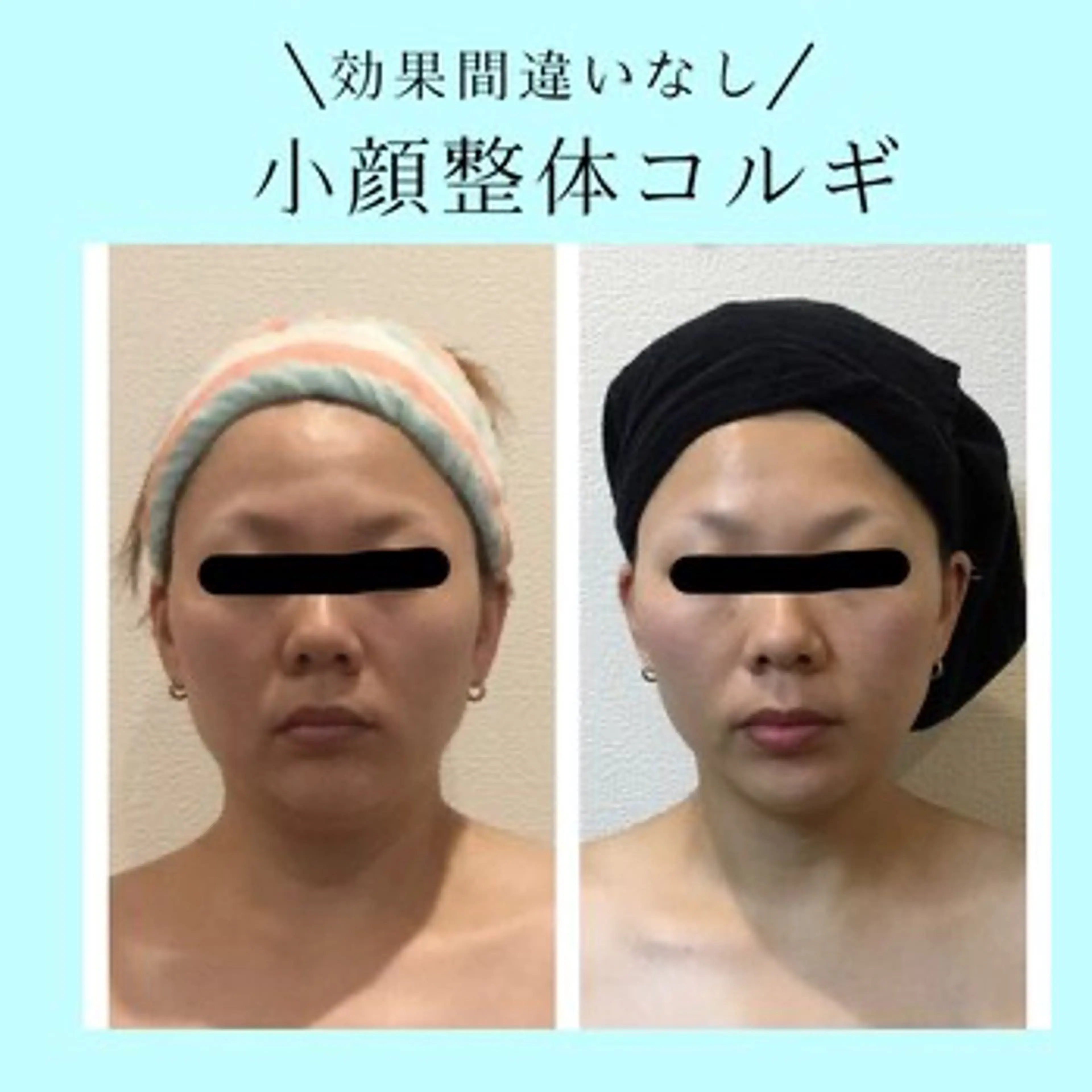 エステ 小顔FaceLabo.那覇店所属・小顔フェイスラボ 那覇店のエステ・リラクイメージ