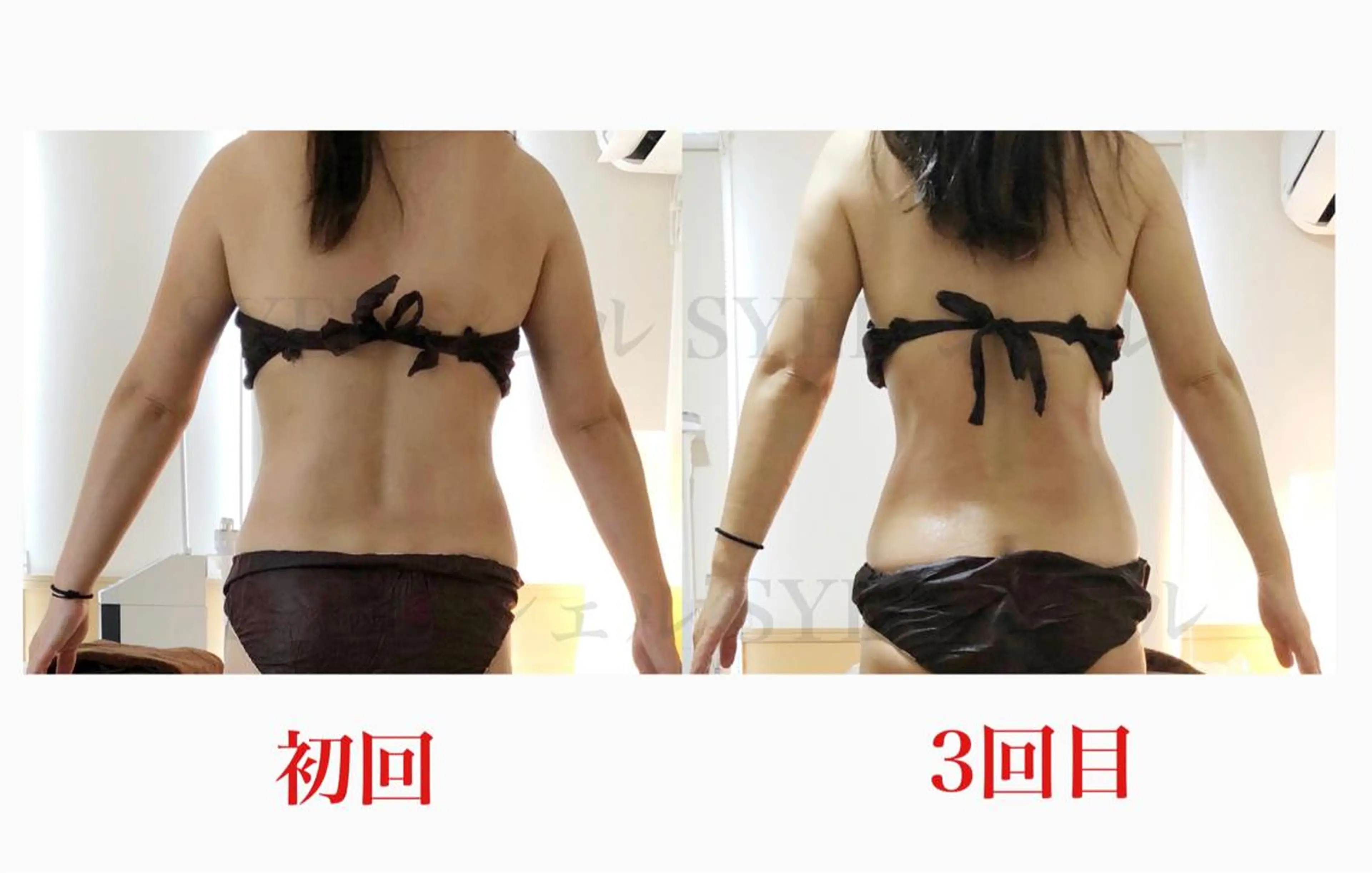 当店お勧めNo.1【THE痩身🔥🔥】の写真