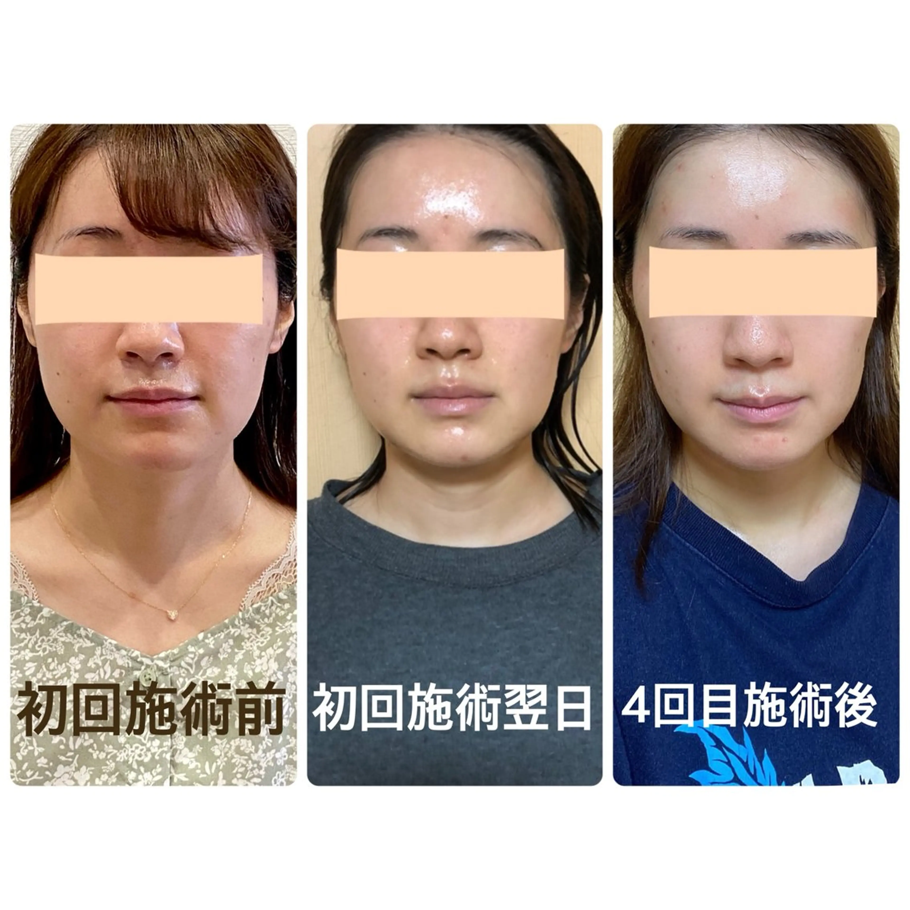 Cream 福井のエステ・リラクイメージ