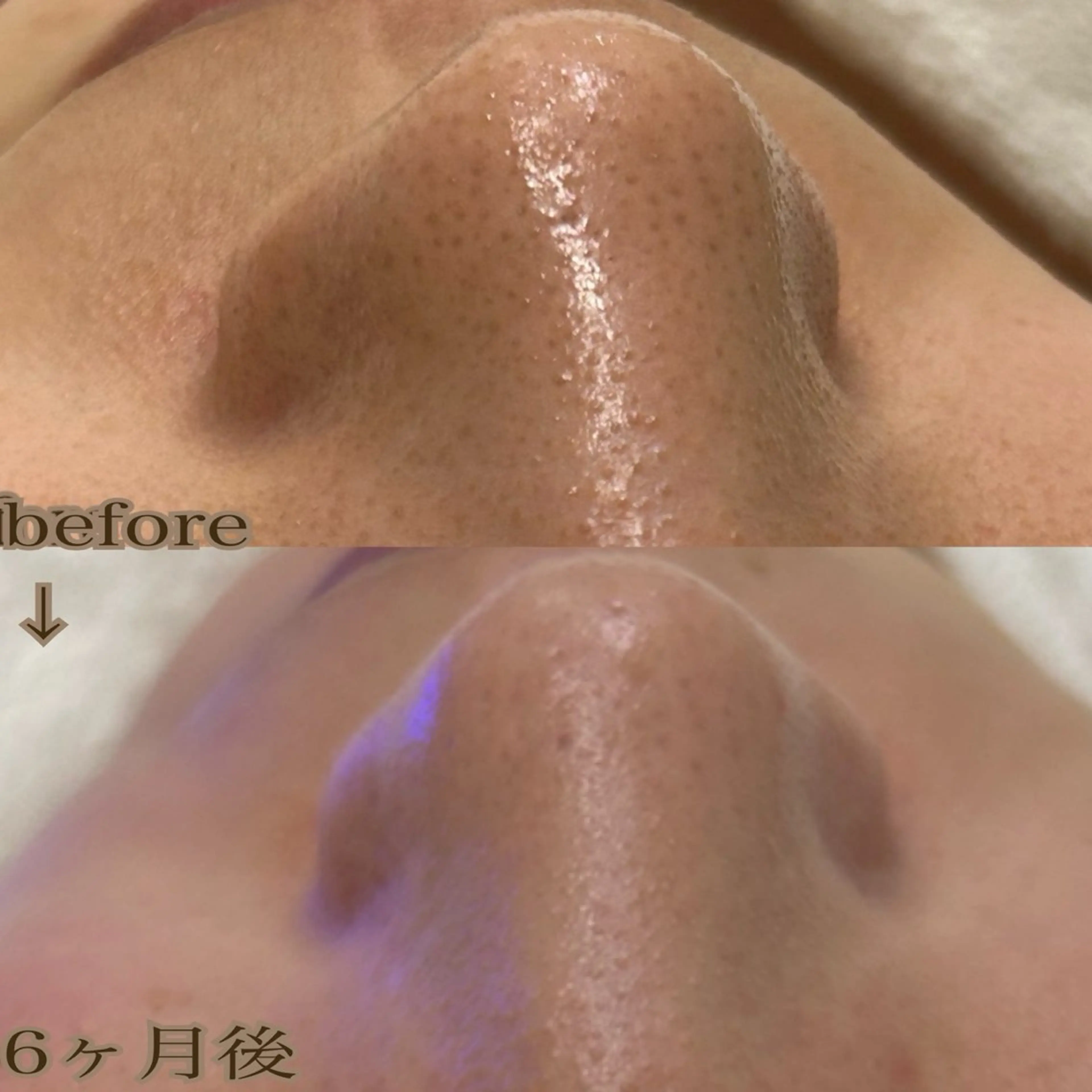 aroma  YURARI所属・韓国艶美人// 毛穴ケア🌹のエステ・リラクイメージ