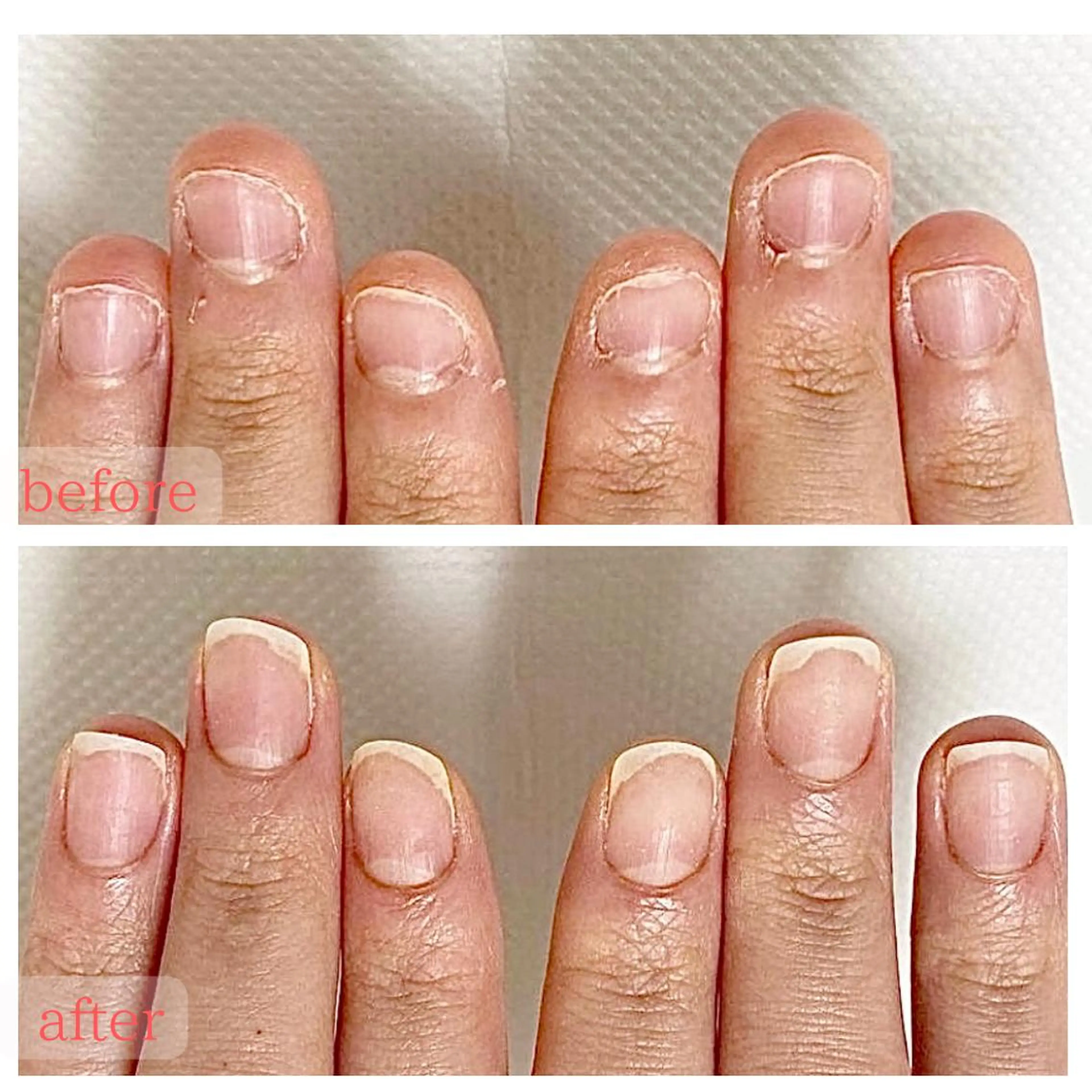 ネイル 深爪・巻き爪 専門サンセリテのネイルデザイン