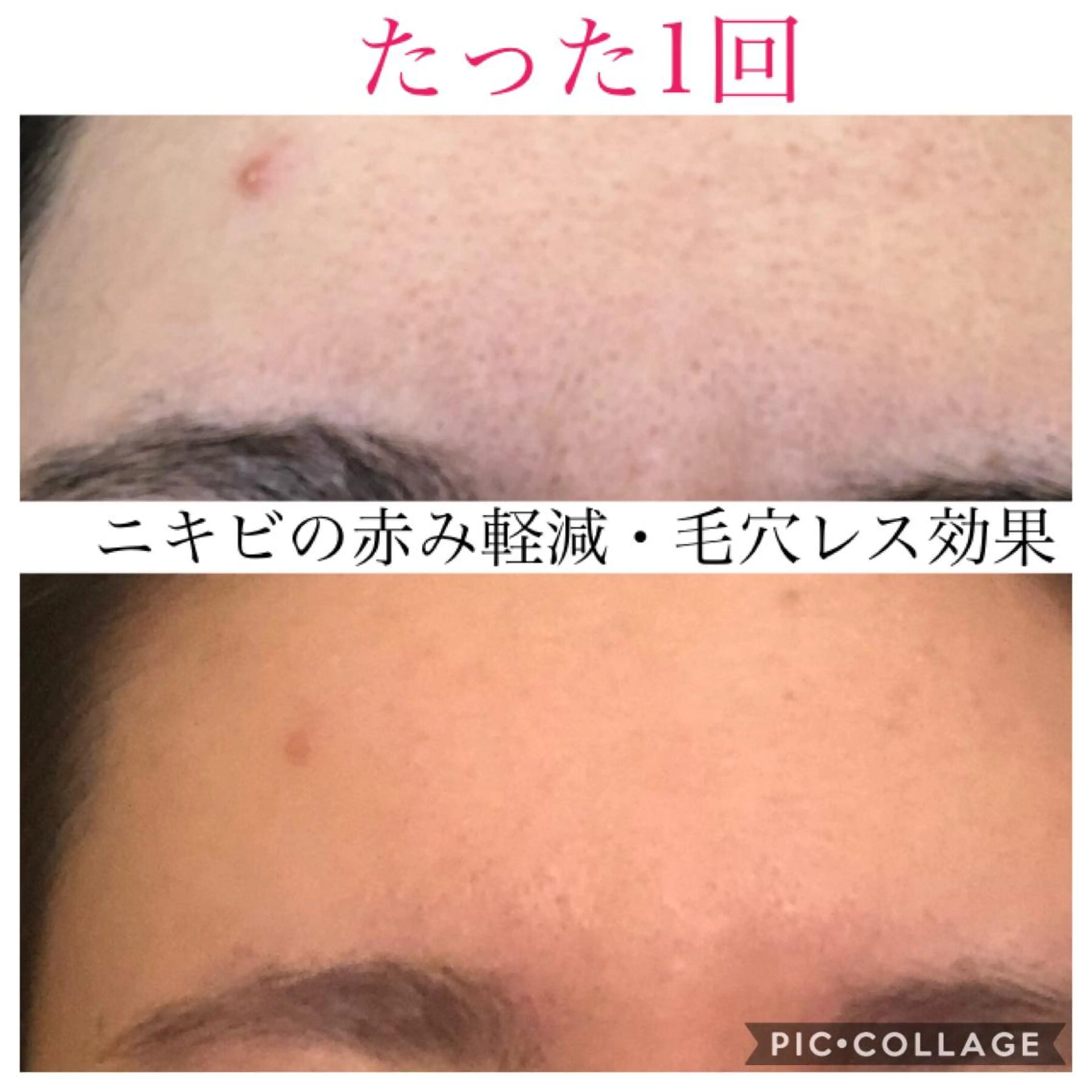 ショート カラー パーマ ヘアアレンジ キッズ ネイル マツエク・マツパ エステ リラク Ensor Clair所属・EnsorClair 代表　野口真央のエステ・リラクイメージ