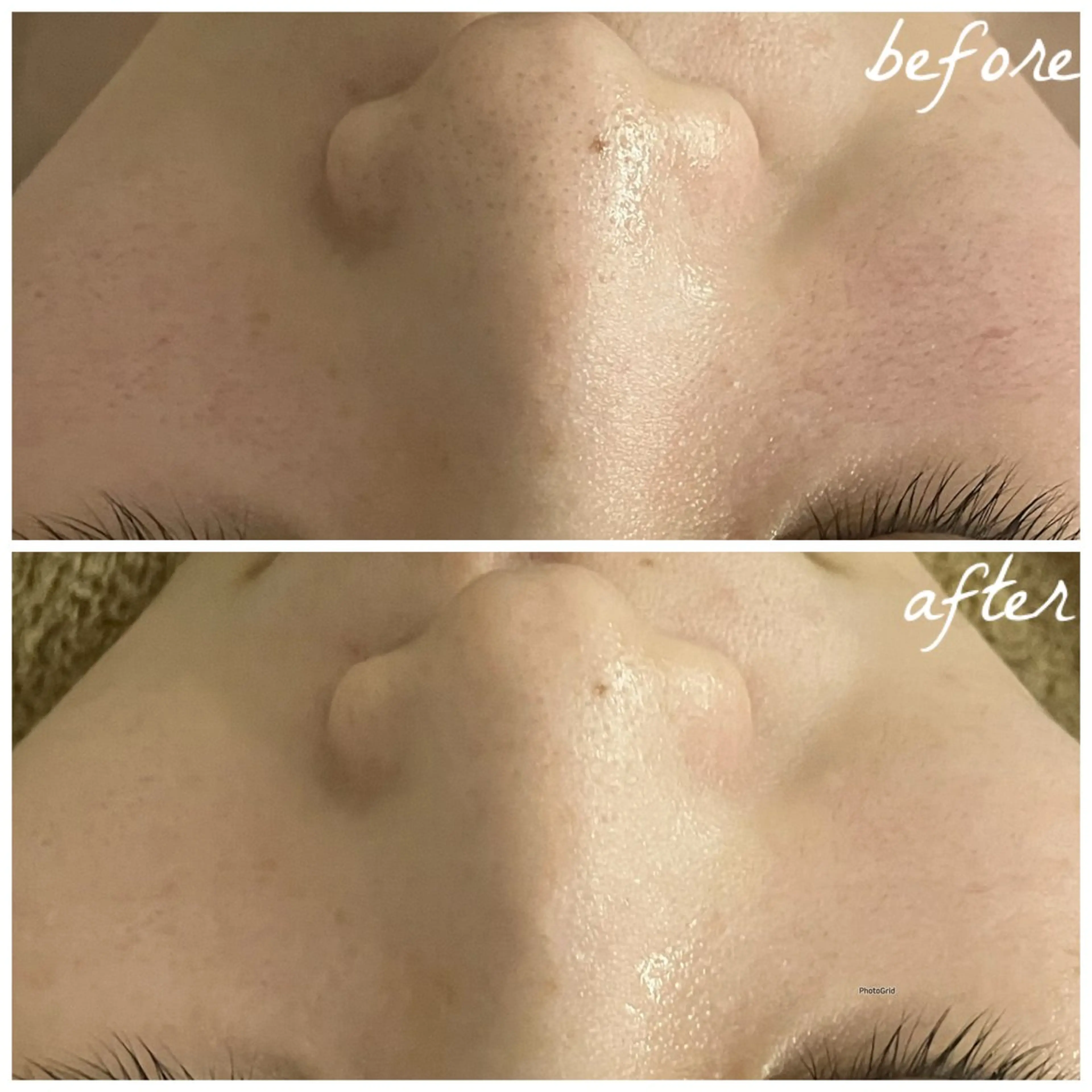 メンズ エステ メナード岐阜茜部 杉浦のエステ・リラクイメージ