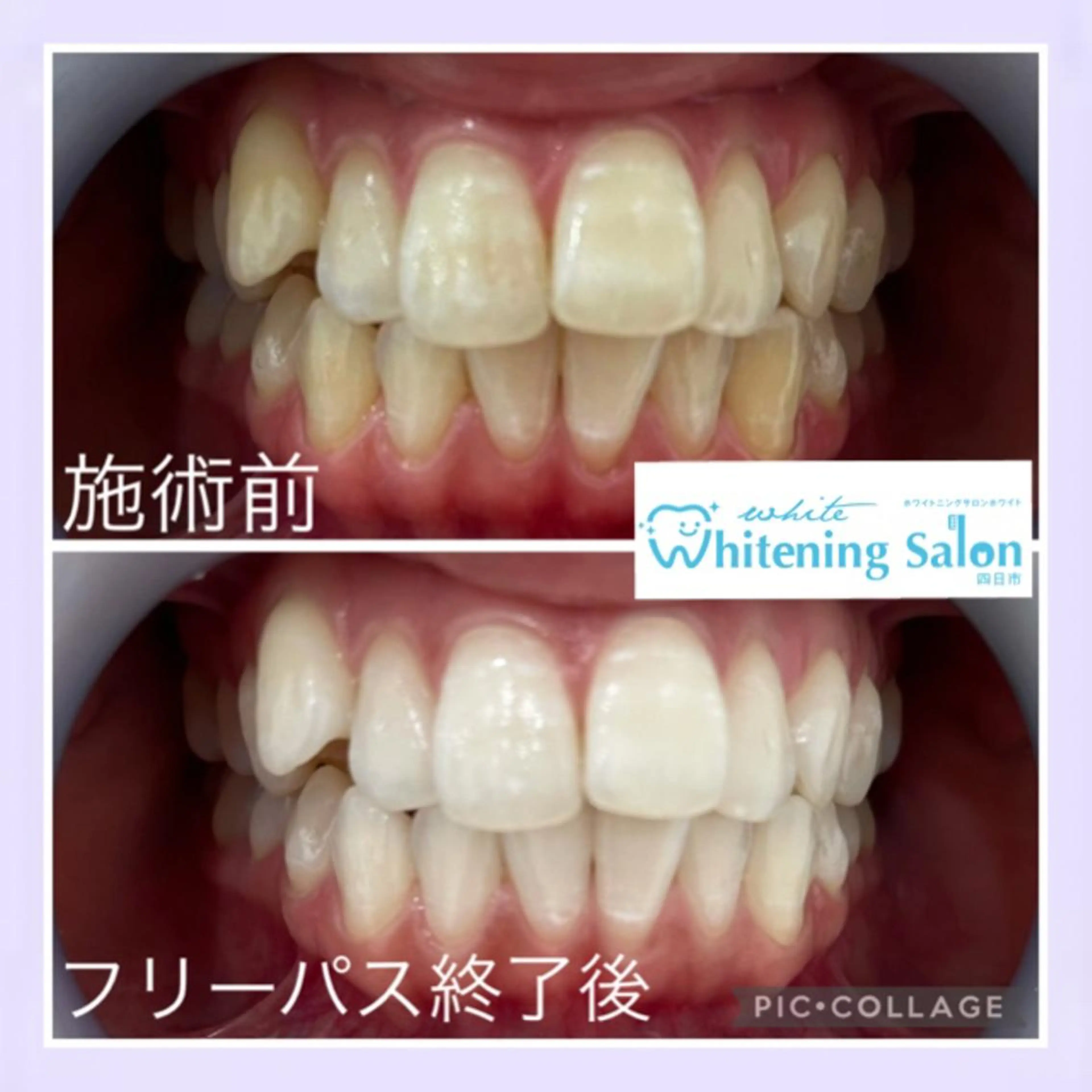 ショート メンズ キッズ ネイル マツエク・マツパ ホワイトニング&アイラッシュ四日市ホワイト所属・アイラッシュ ホワイトニング四日市のマツエク・マツパデザイン