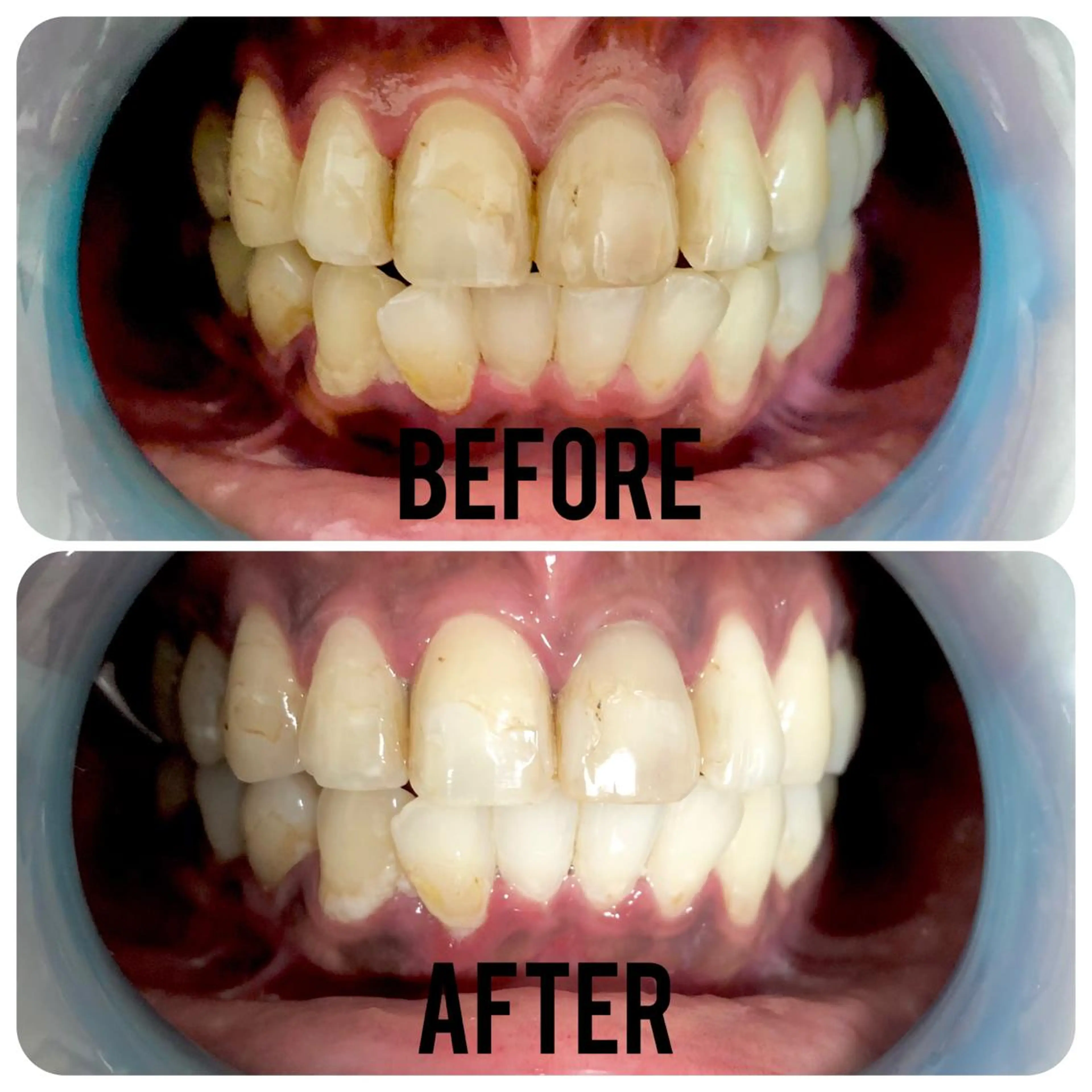 その他 two nailのネイルデザイン