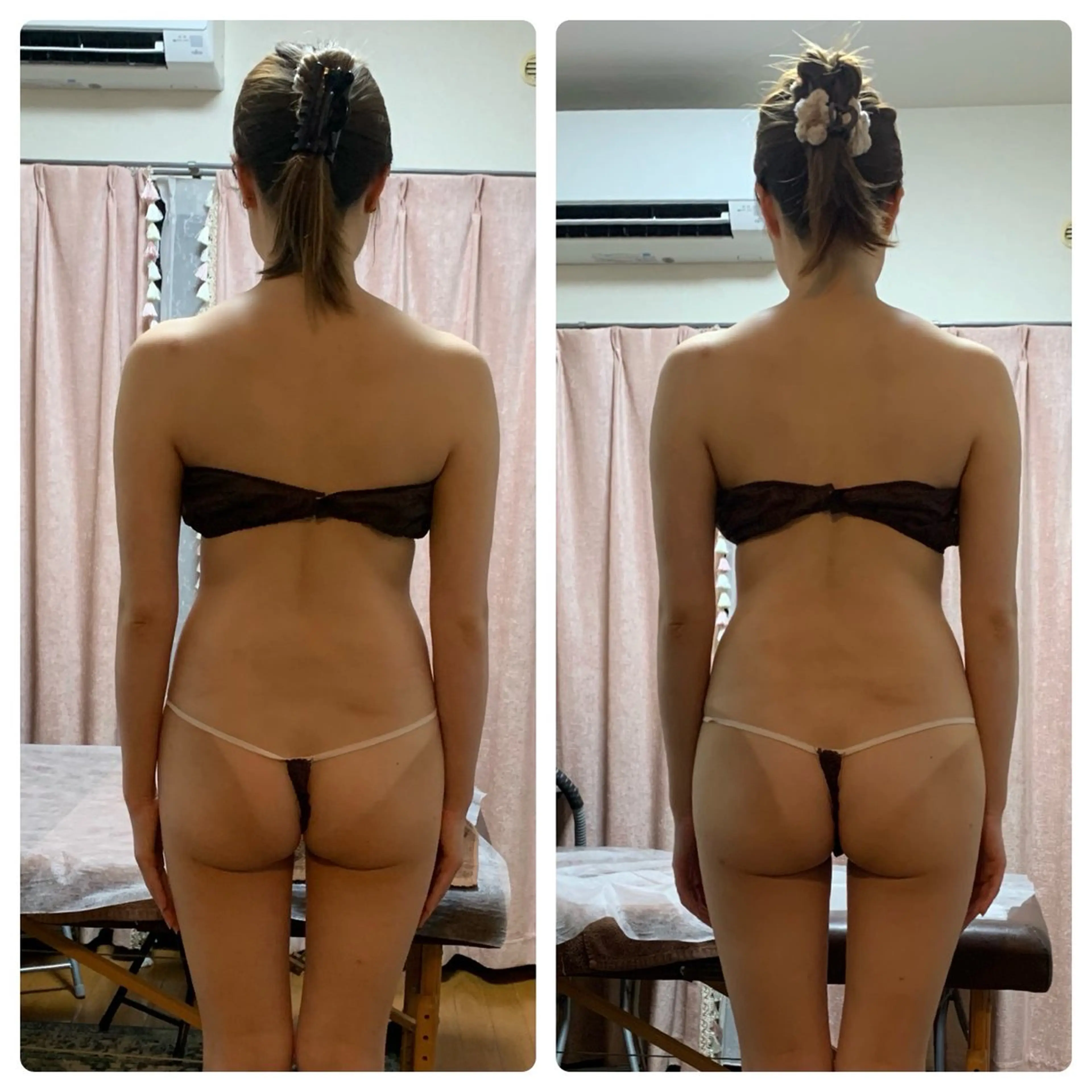 ソワン所属・脱毛 フェイシャル soin～ソワン～のエステ・リラクイメージ