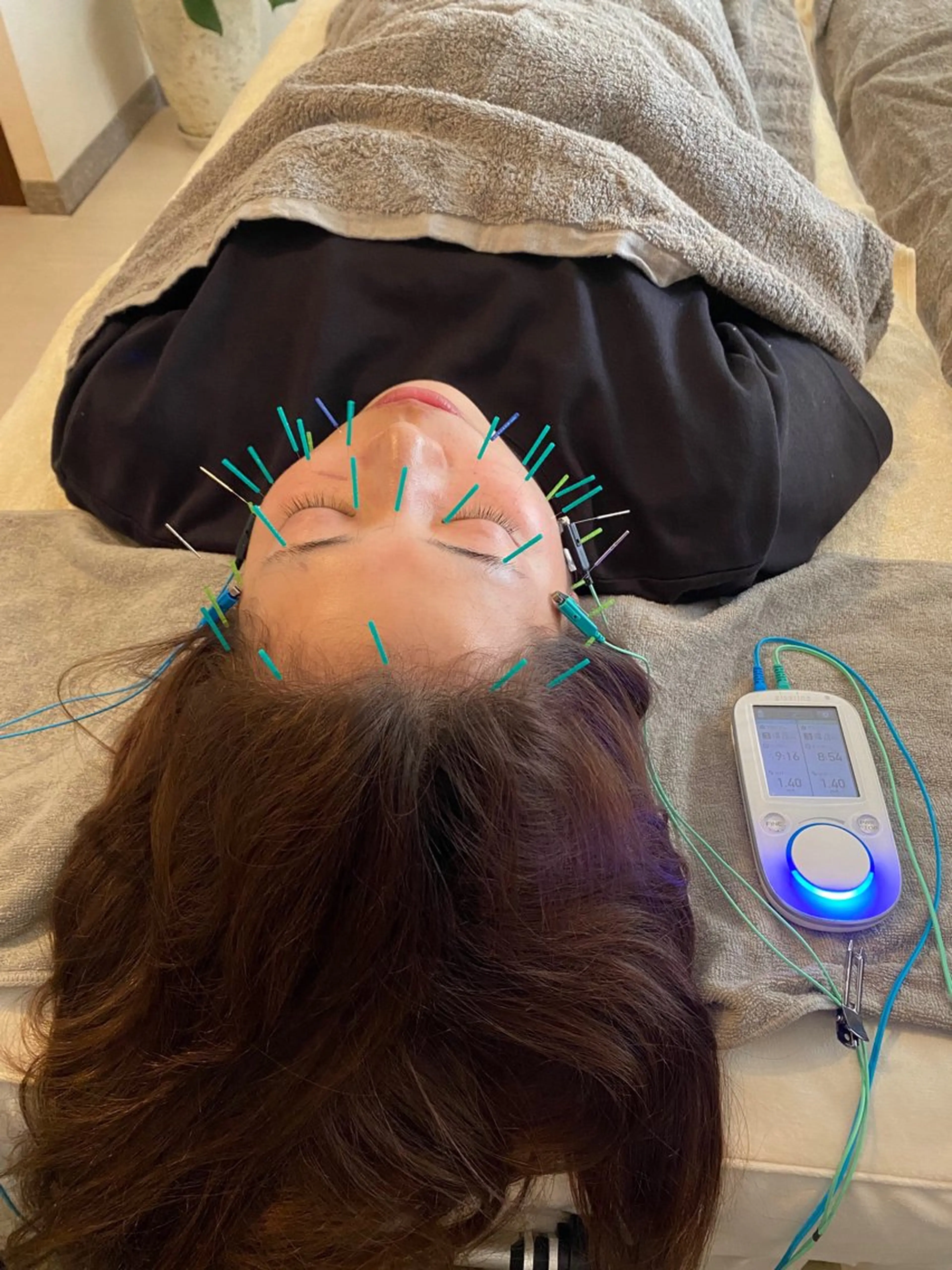 エステ リラク 鍼灸•マッサージサロンCalfa所属・《美肌･小顔》美容鍼 ＆マッサージ＊MEIのエステ・リラクイメージ