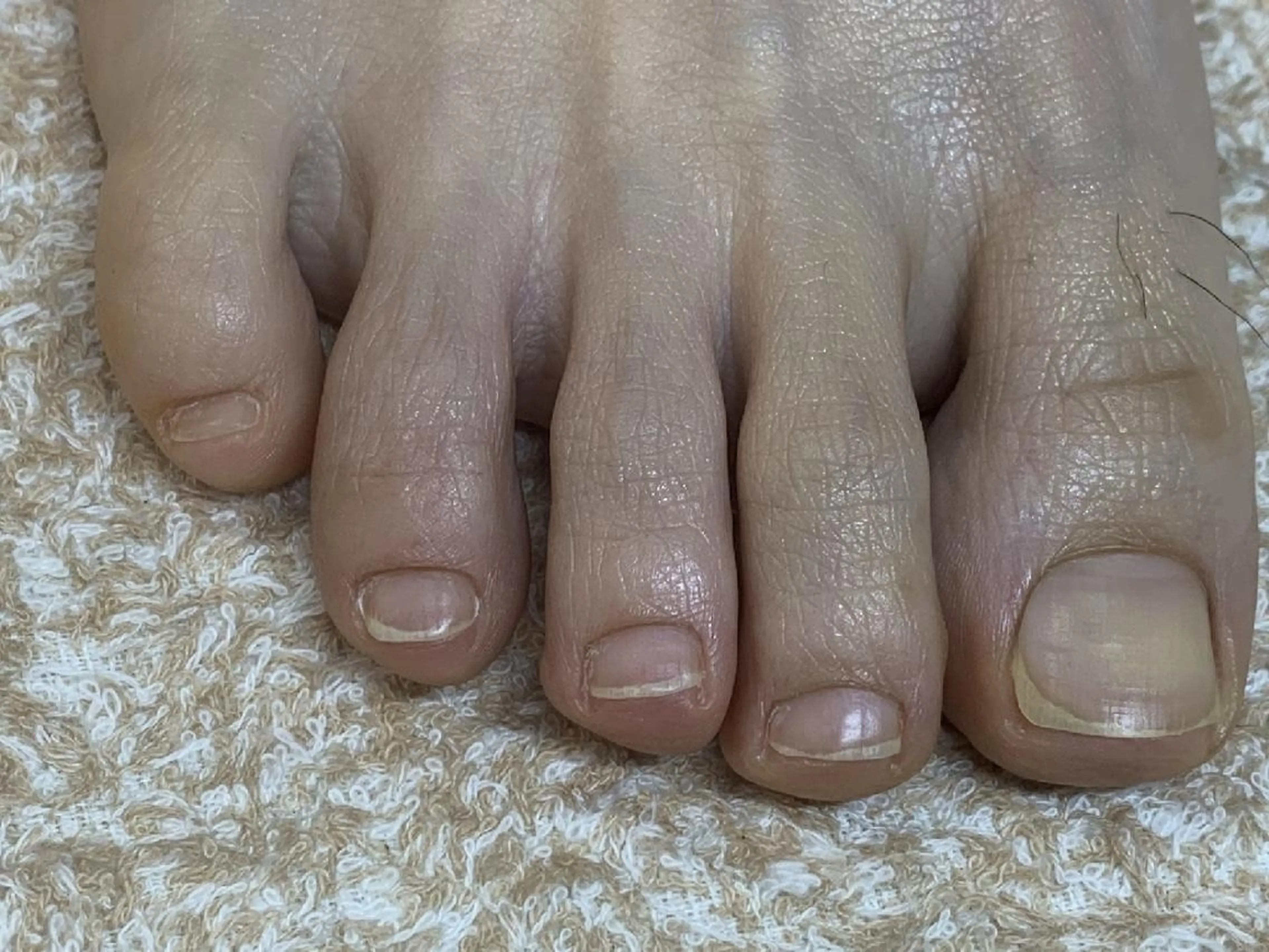 ネイル carenail　 tsugumiのその他イメージ