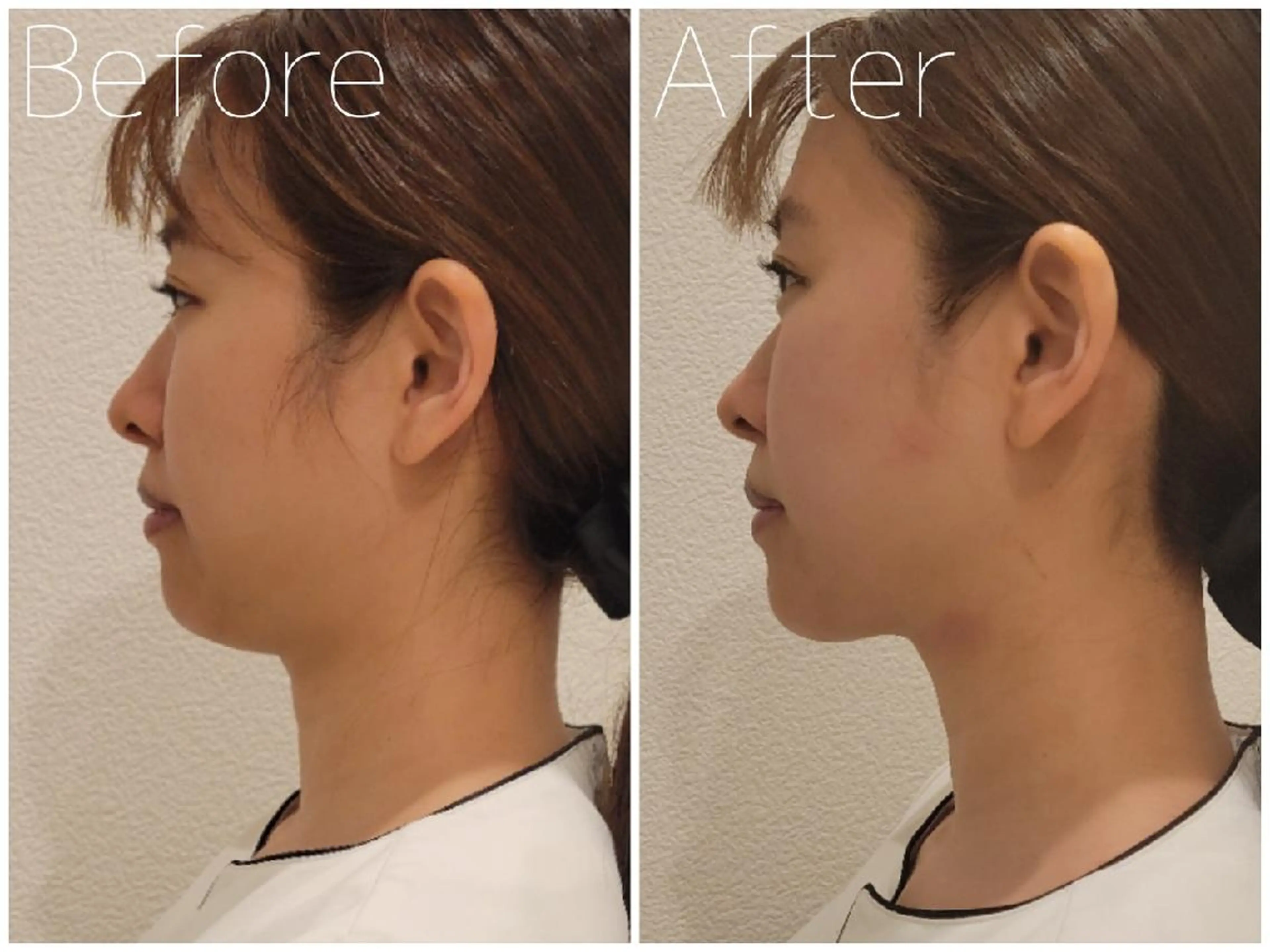 毛穴/肌管理/痩身/ ボディケア/satoのエステ・リラクイメージ