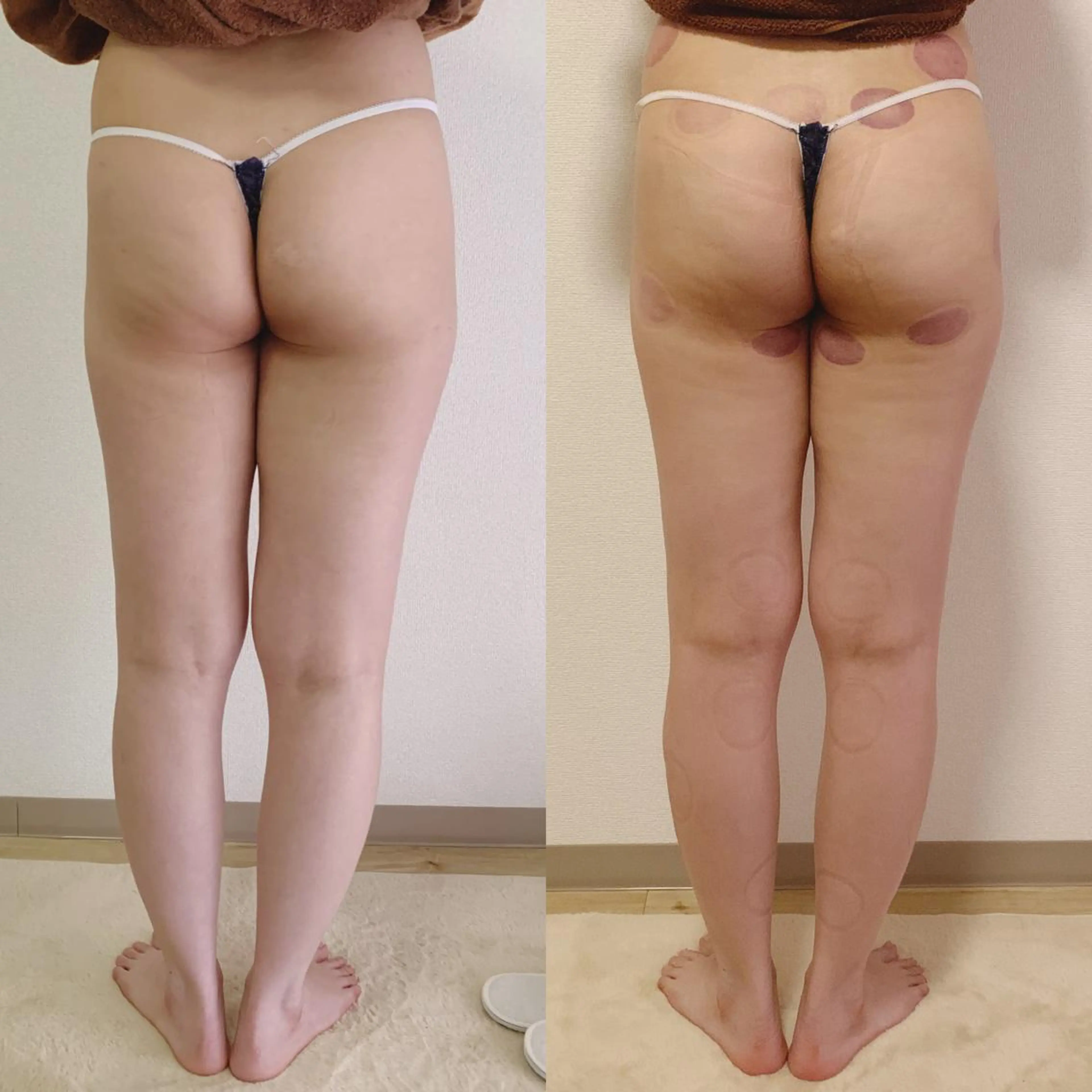 a  room salonのエステ・リラクイメージ