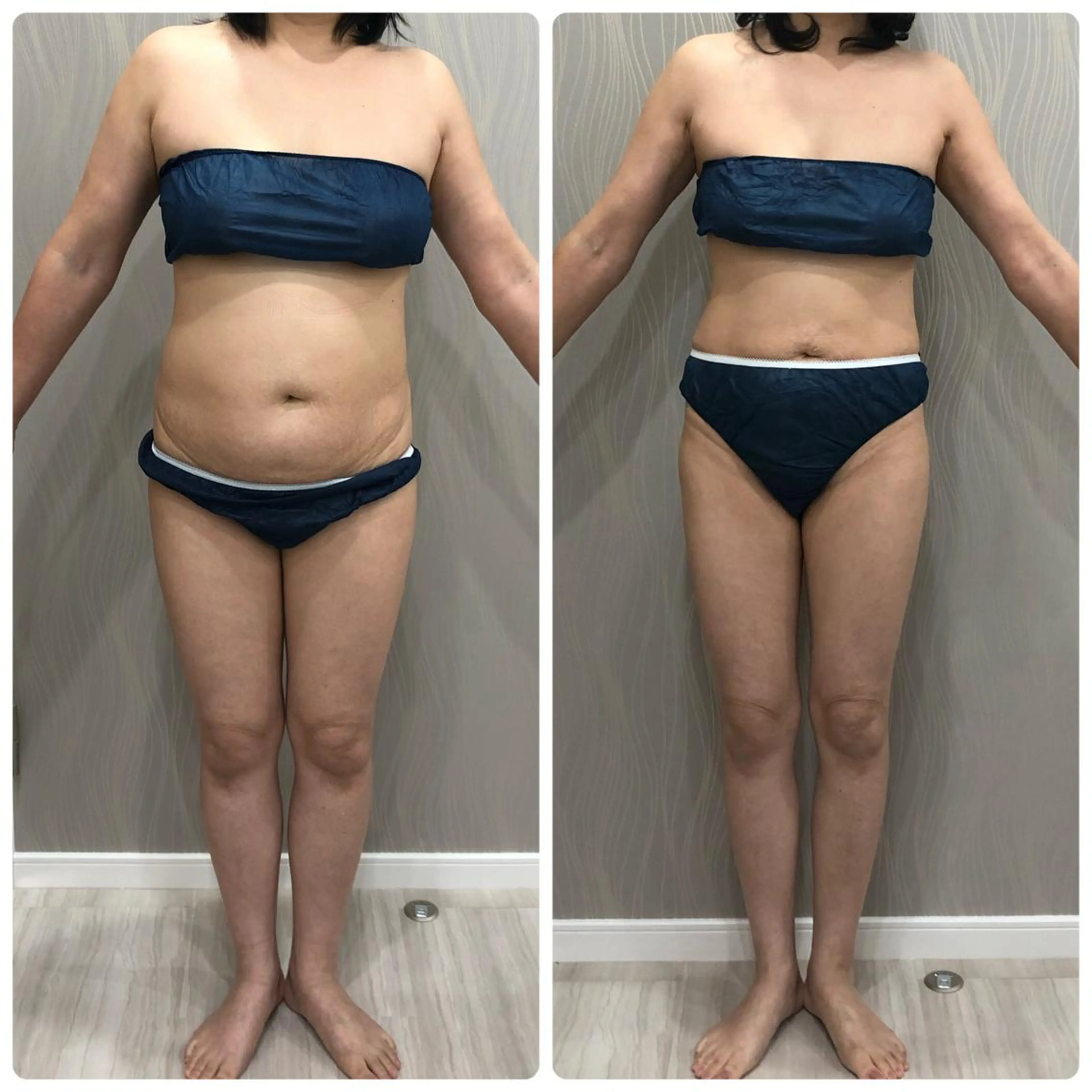 エステティックサロン ベルネのエステ・リラクイメージ