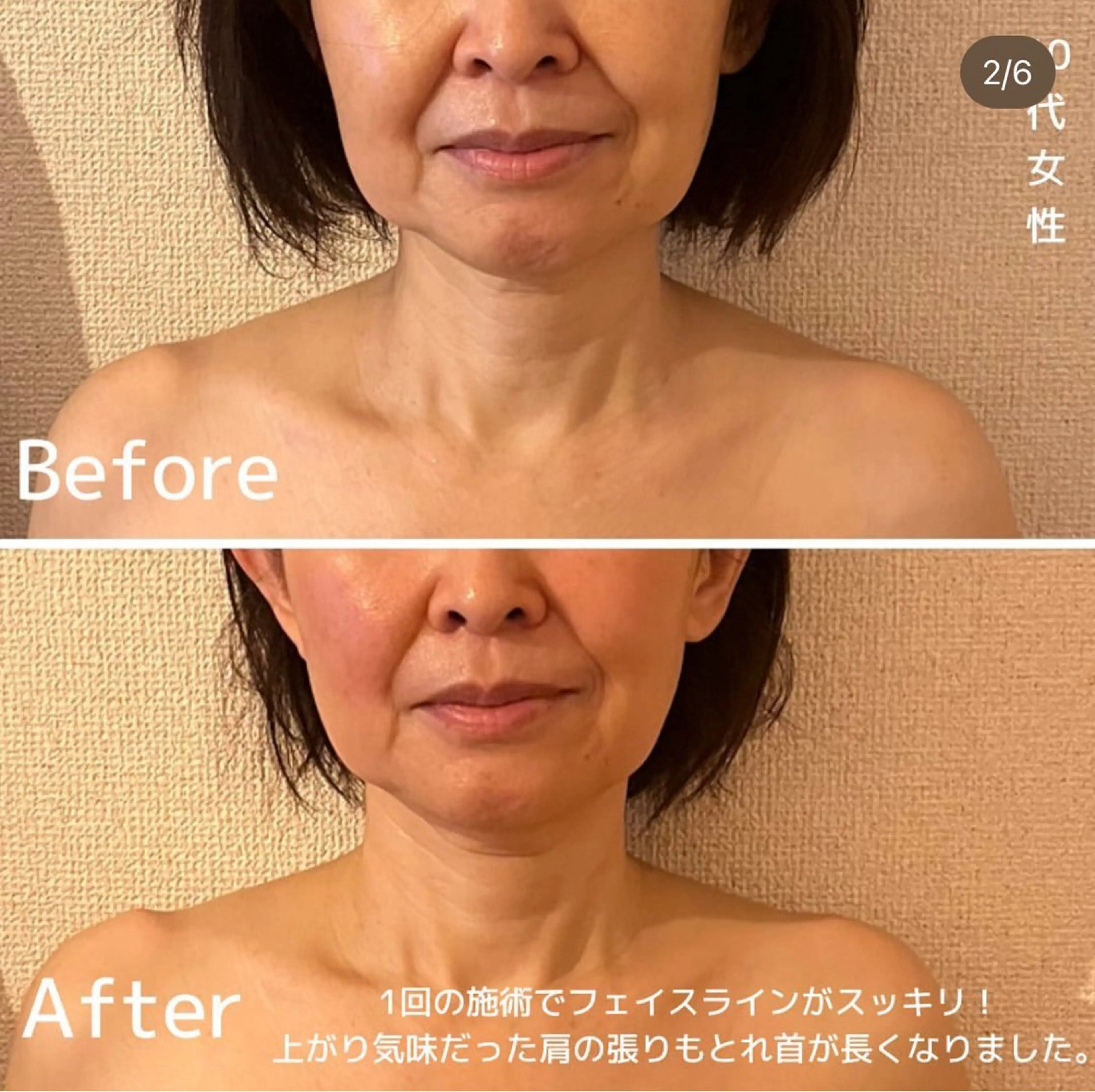 エステ リラク 表情筋フェイシャル 三軒茶屋のエステ・リラクイメージ