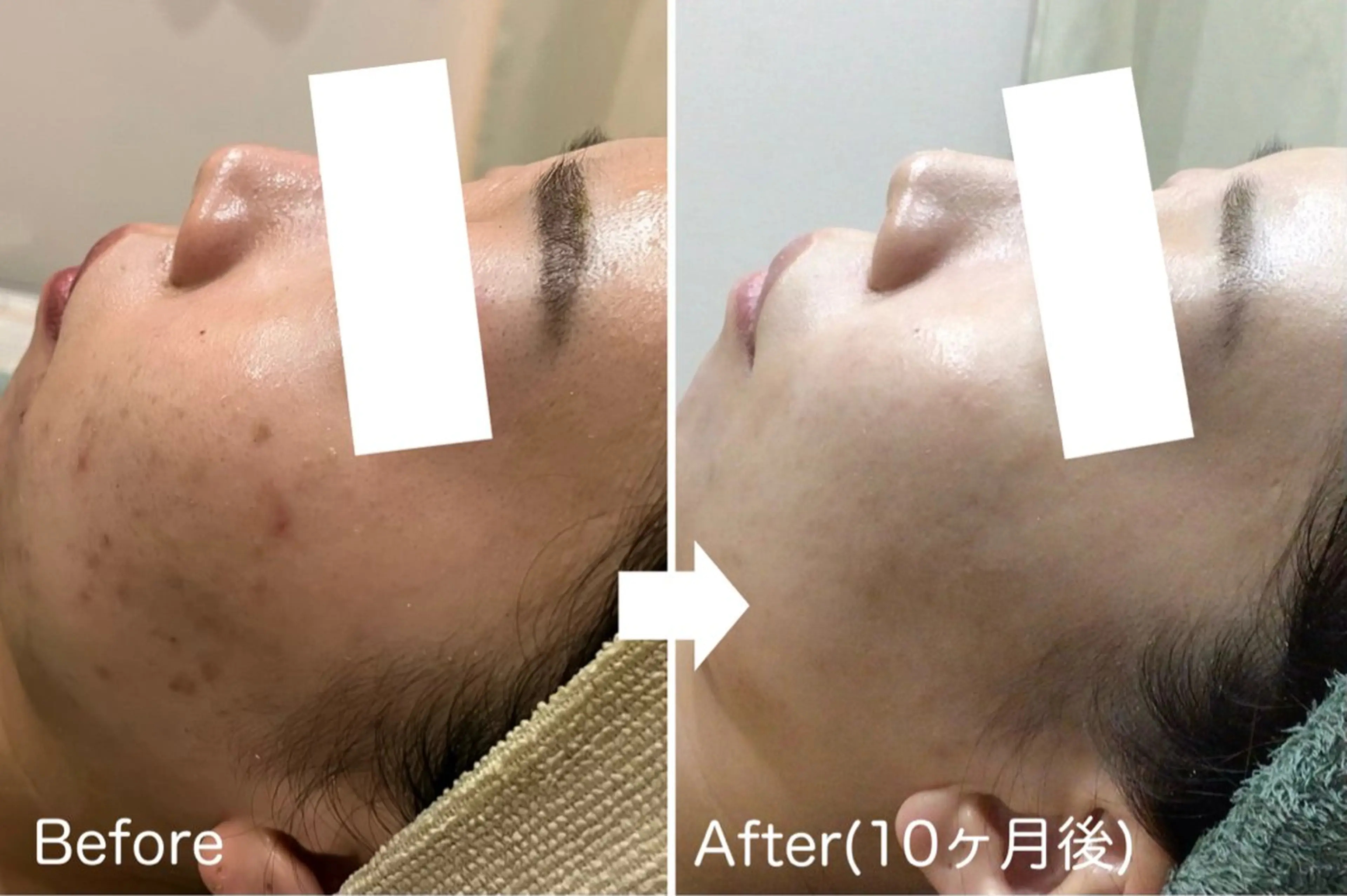 ハーブピーリング専門 muro.のエステ・リラクイメージ