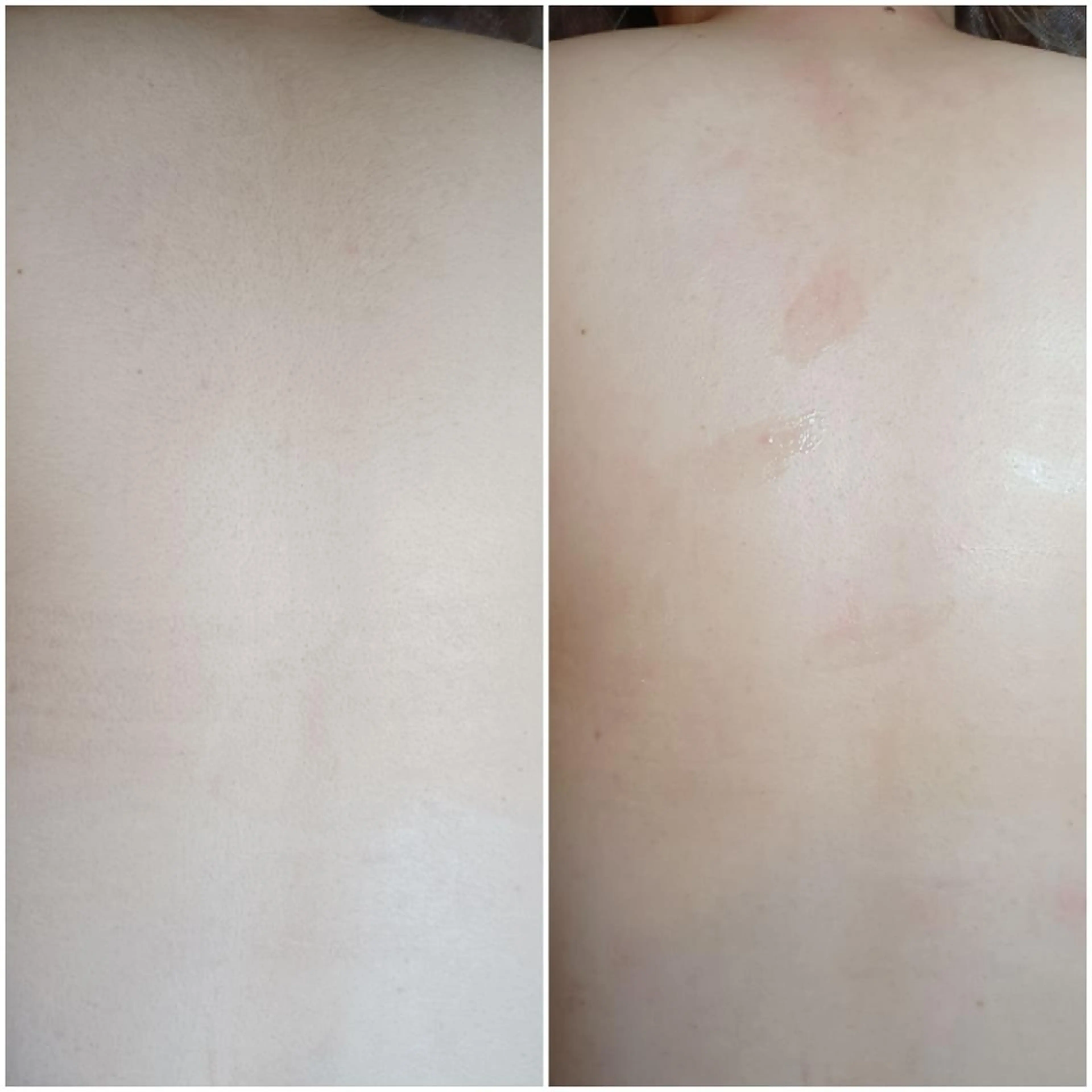 Lutella所属・ワックス脱毛専門店 Lutellaのエステ・リラクイメージ