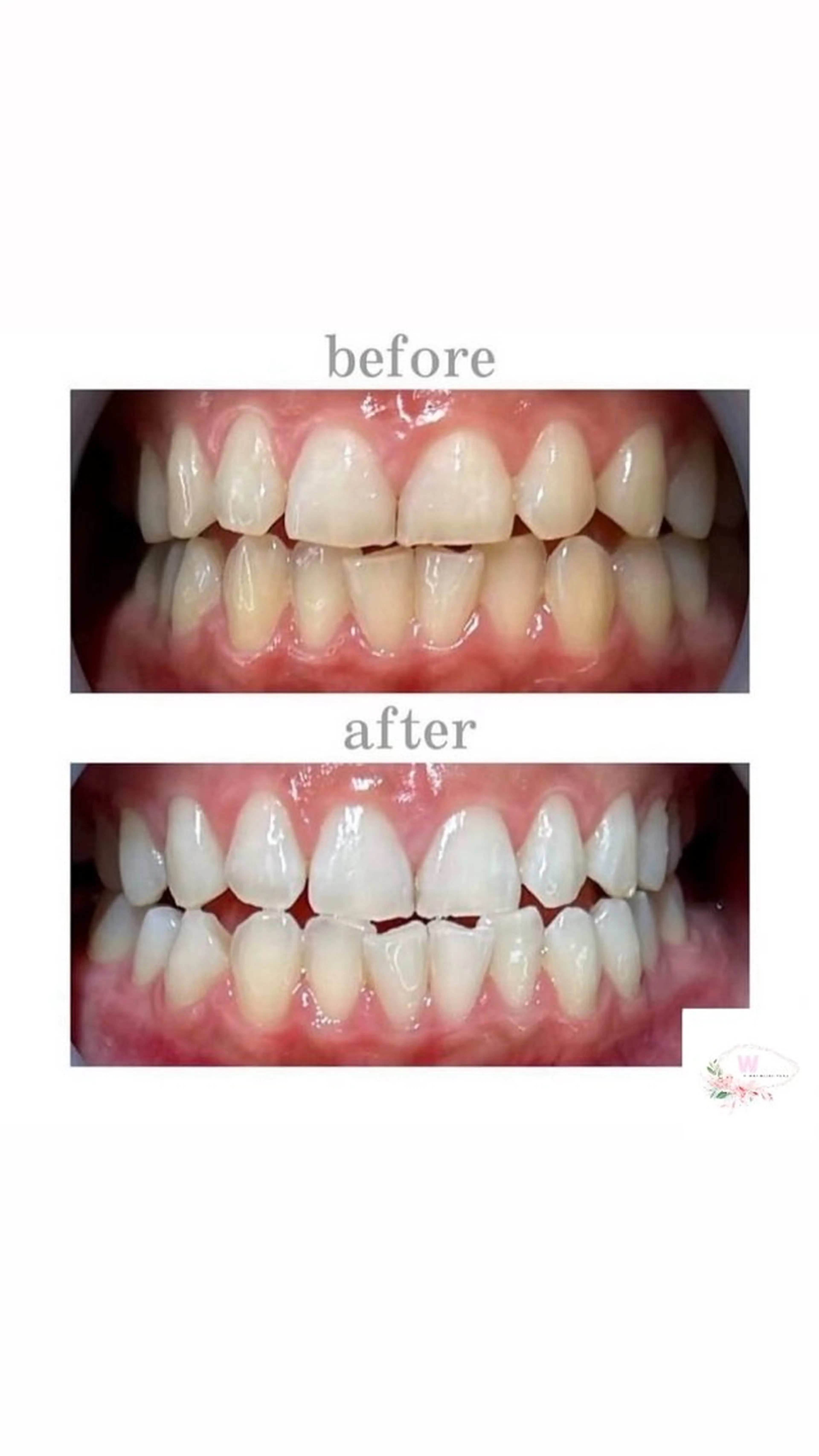 【メンズ専用クーポン】40分照射➕カウンセリング※口コミ必須の写真