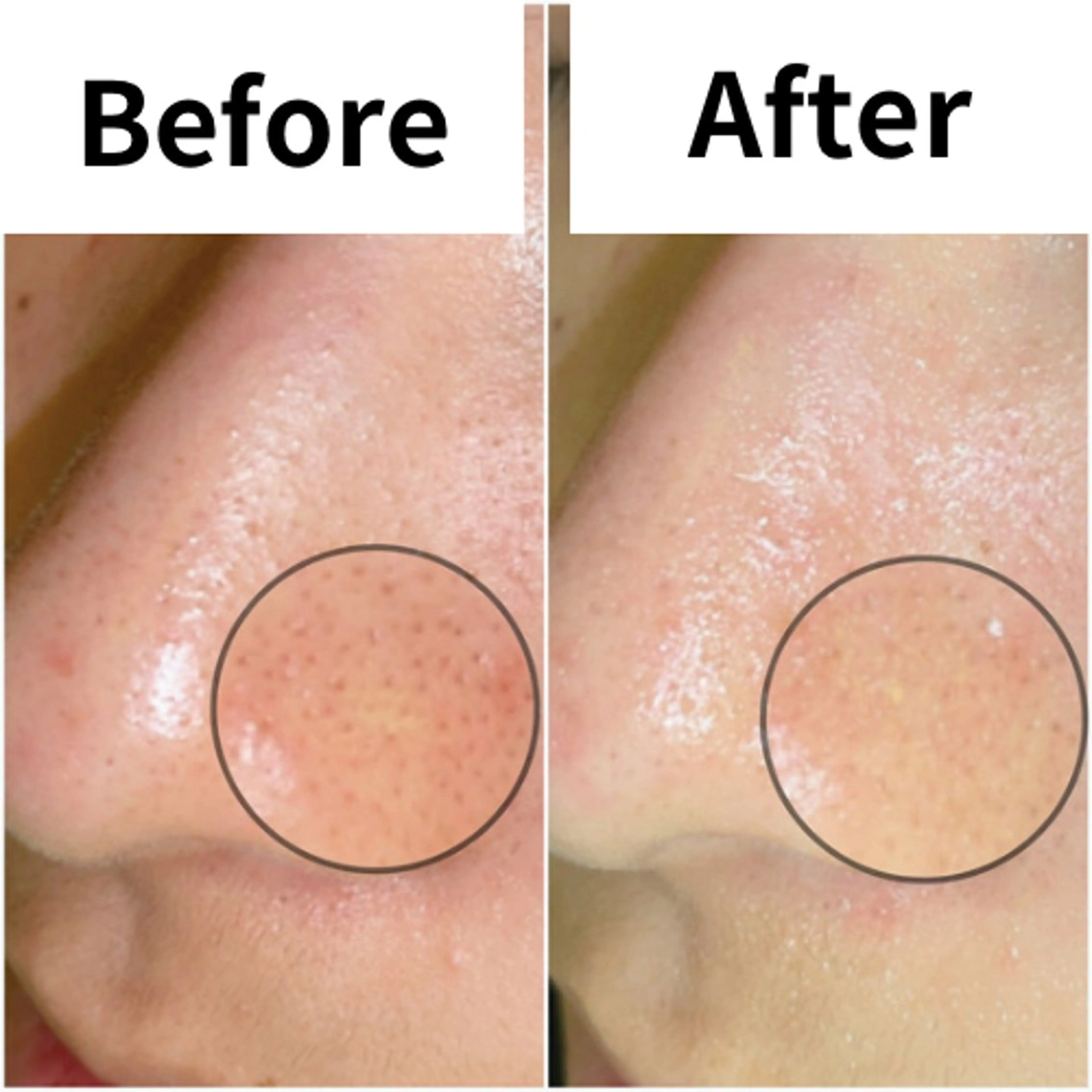 エステ SELF  BEAUTY gracia浦添店所属・gracia 浦添店のその他イメージ