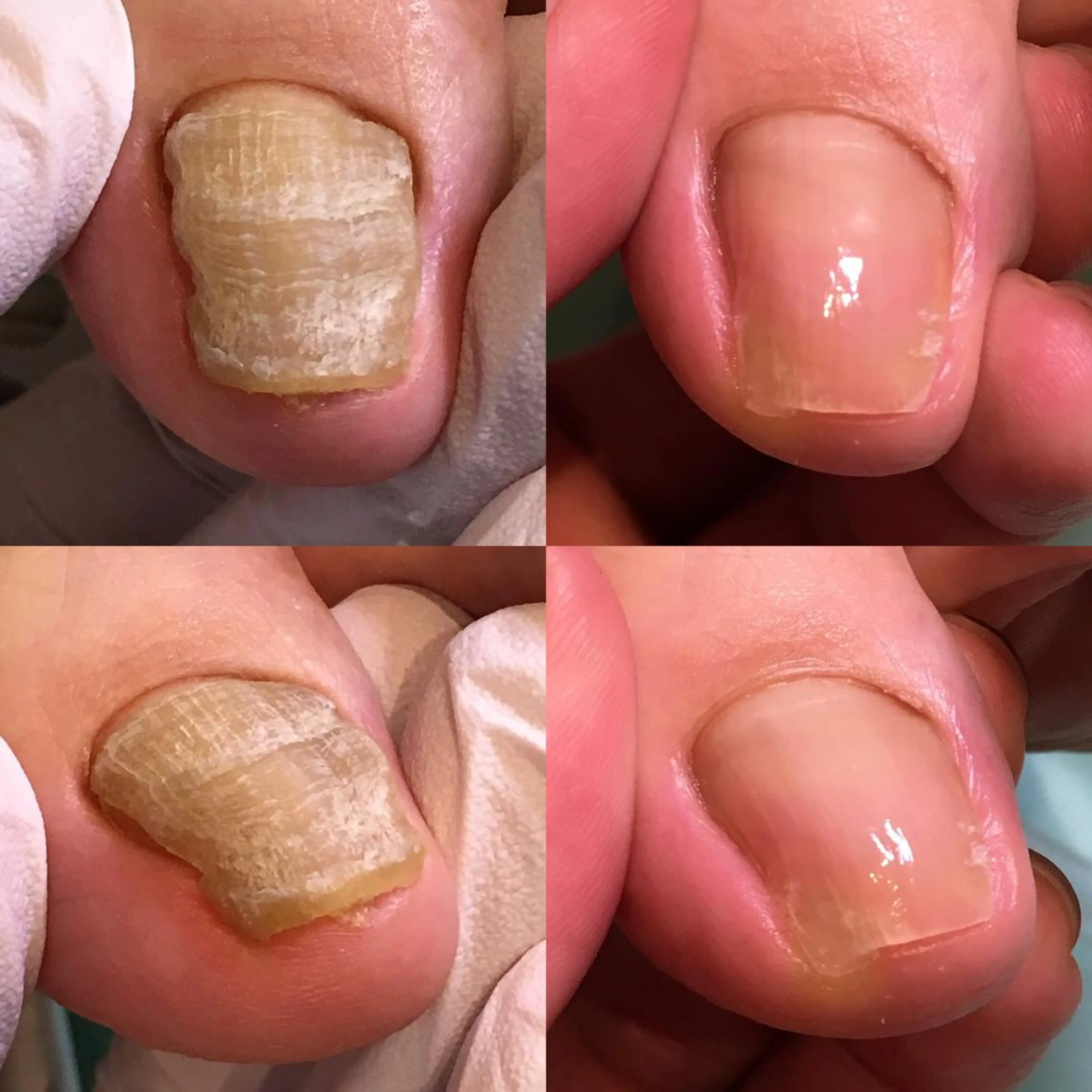 東京巻き爪アカデミー所属・東京巻き爪 アカデミーのエステ・リラクイメージ