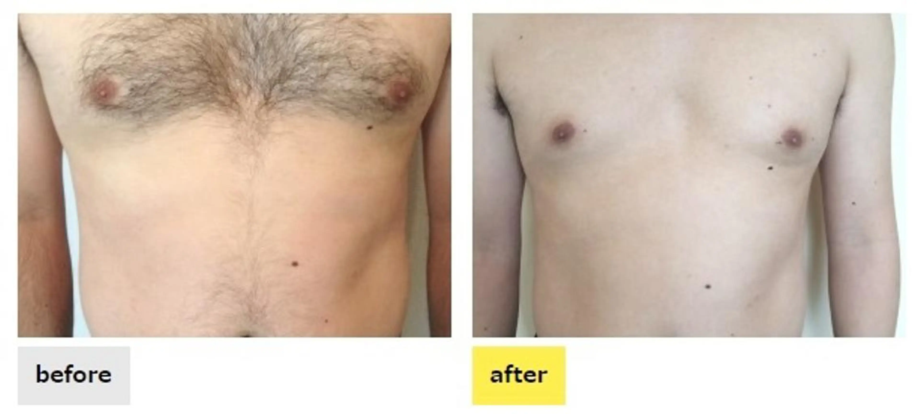 メンズ 脱毛 都度払い脱毛⭐️ 脱毛サロンMIRACのエステ・リラクイメージ