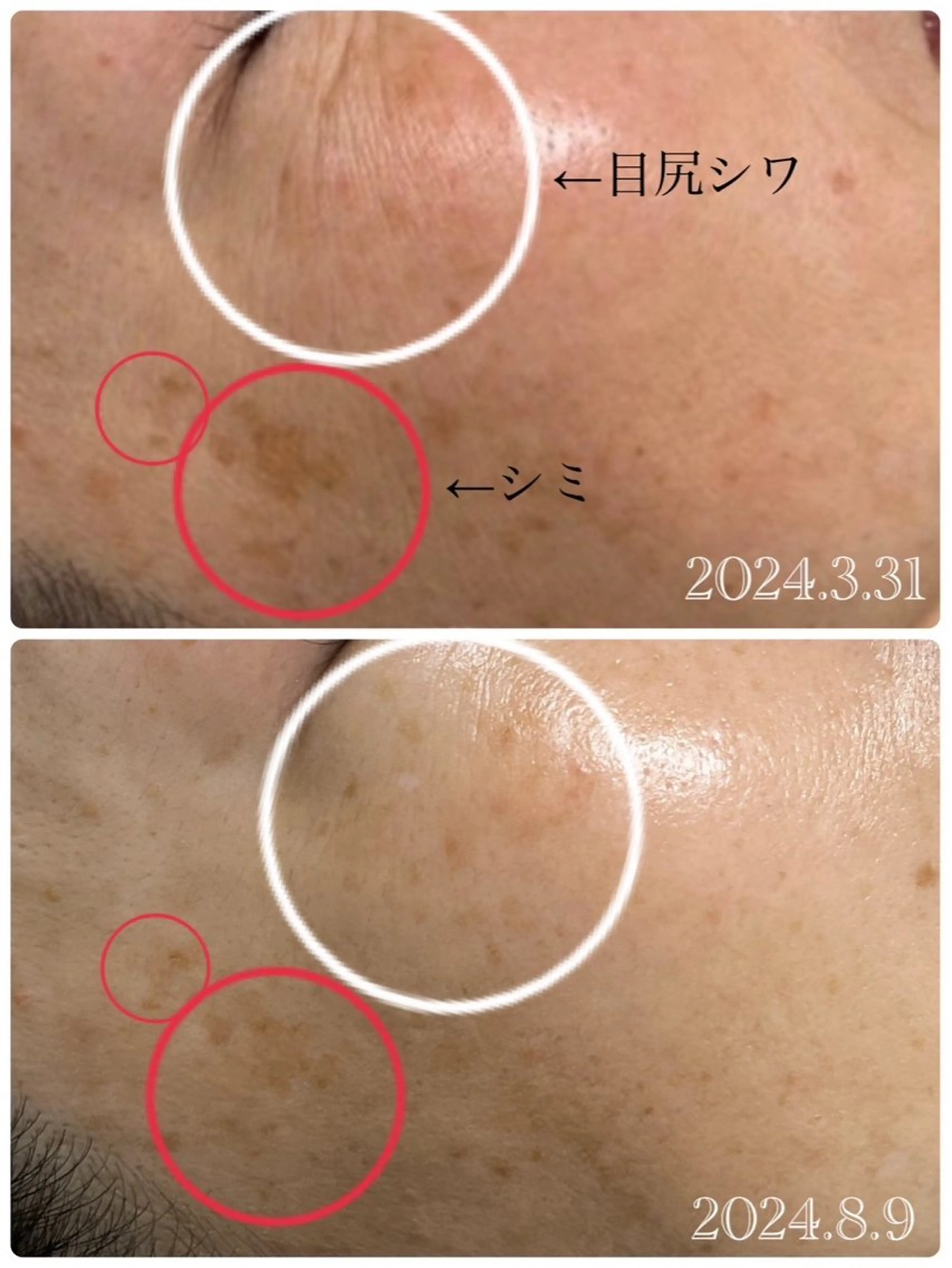 エステ Luquias✴︎ Mizukiのエステ・リラクイメージ