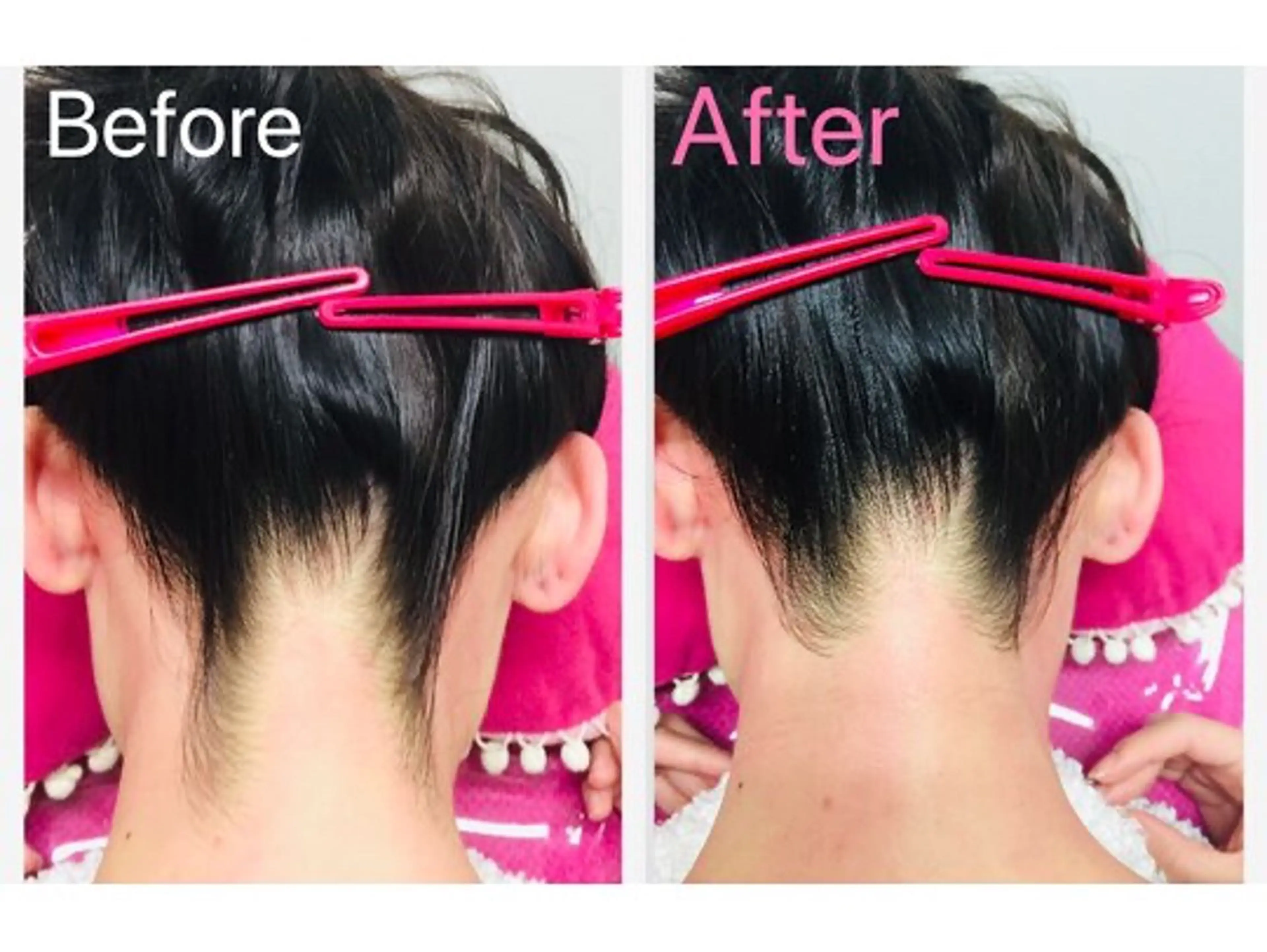 脱毛 BRILLIANCE ブリリアンスのエステ・リラクイメージ