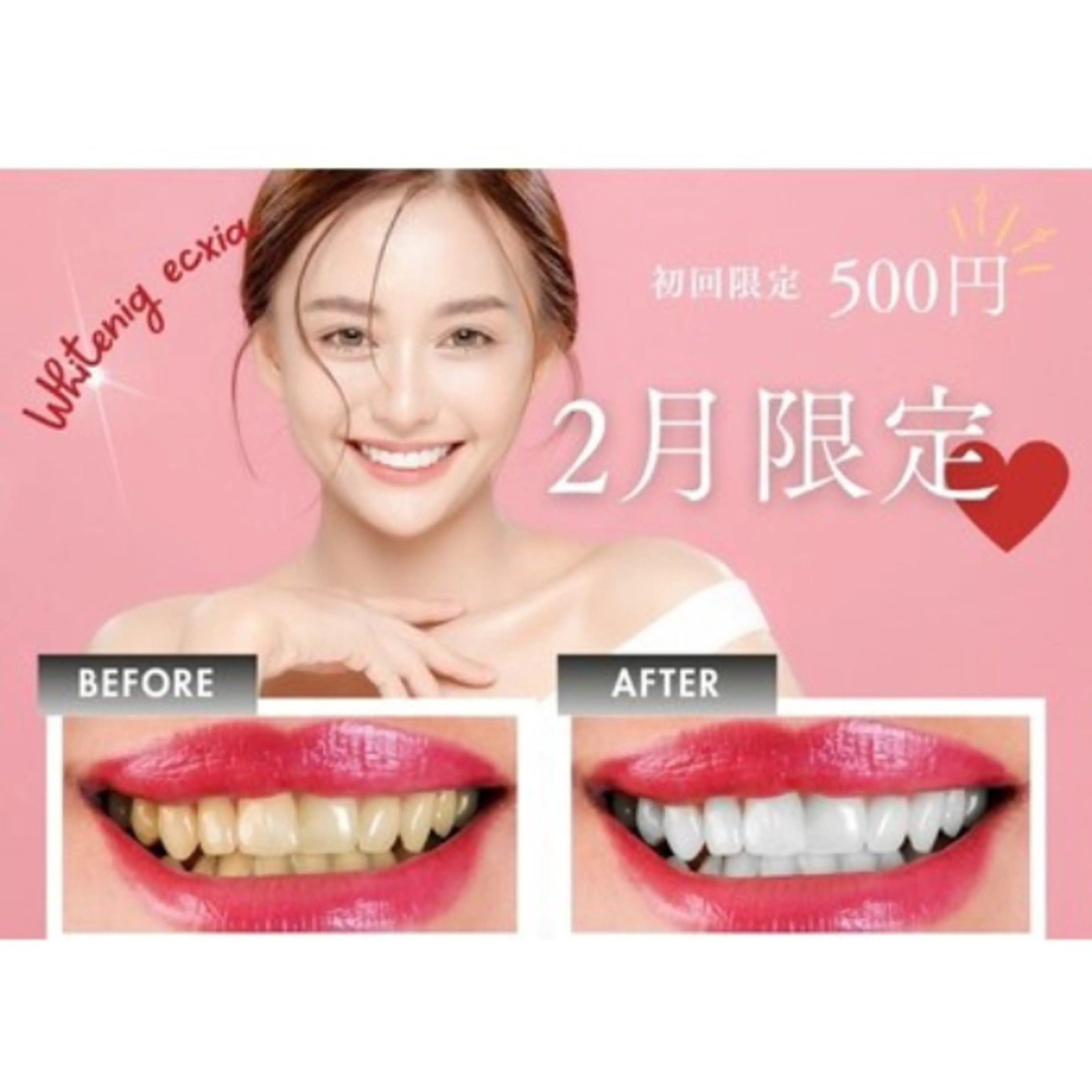 セルフホワイトニング エクシア戸田公園店所属・セルフホワイトニング エクシア戸田公園店のその他イメージ