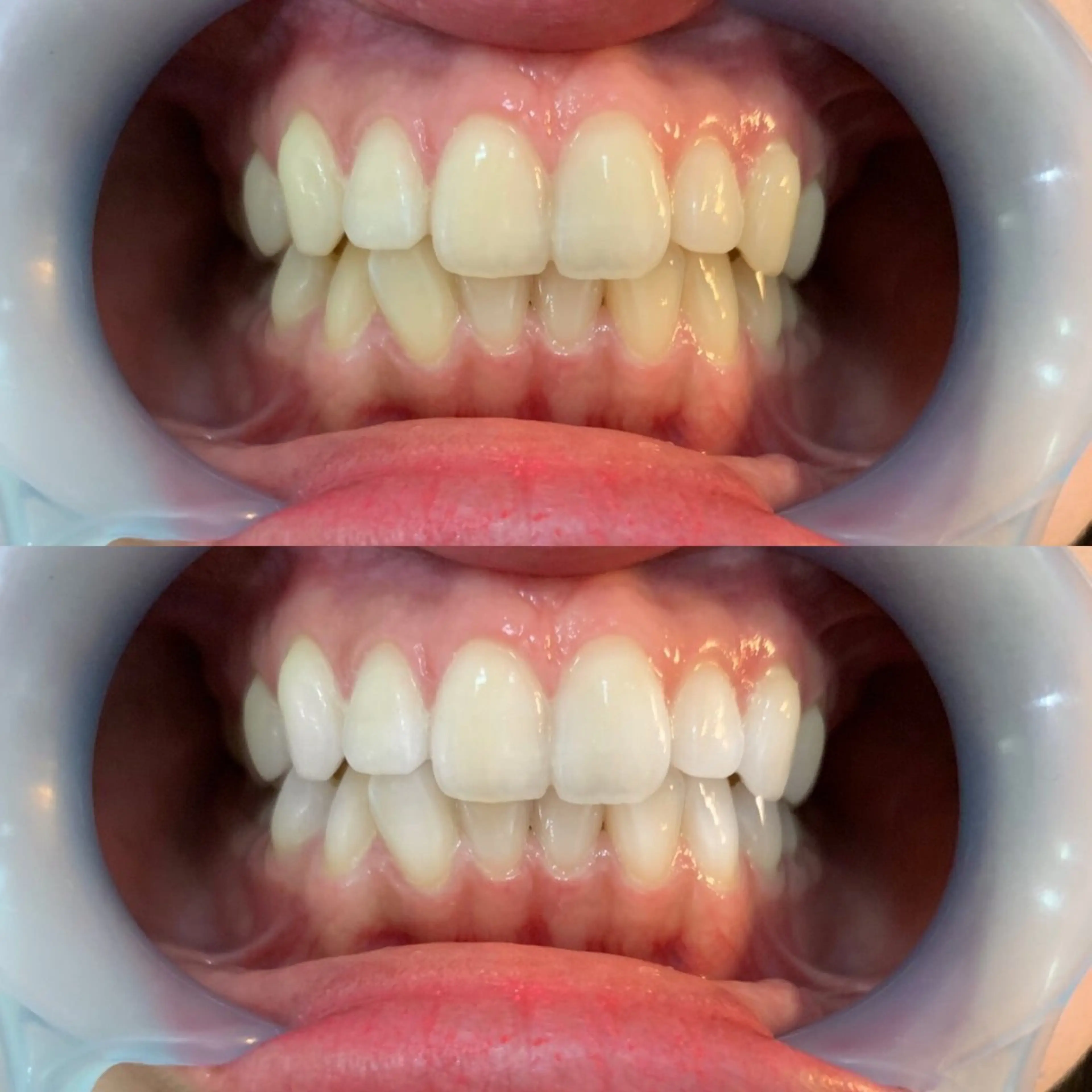 LOVE ホワイトニング新宿店のエステ・リラクイメージ