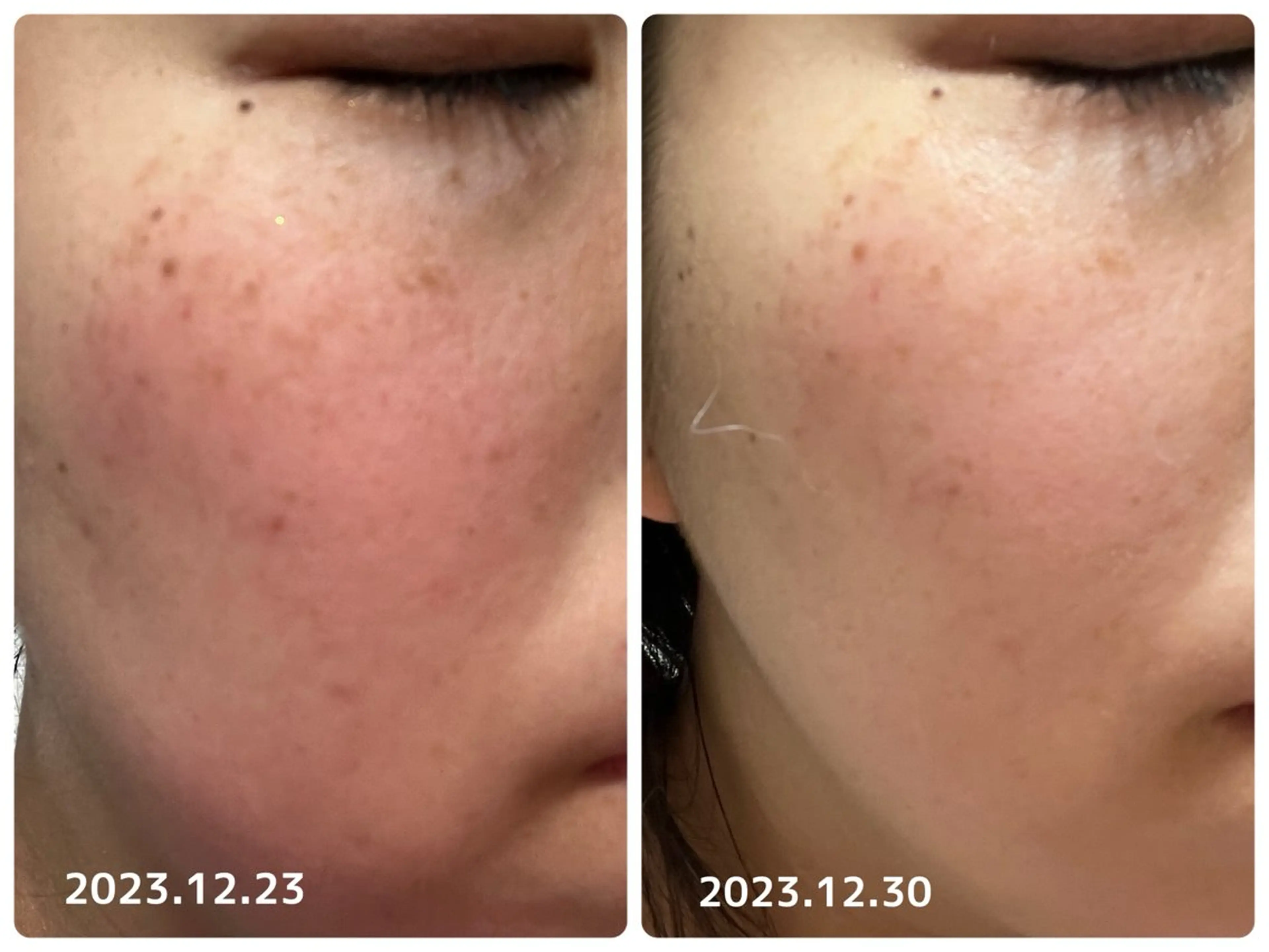 その他 青山・表参道/ 💎肌質改善/inoのその他イメージ