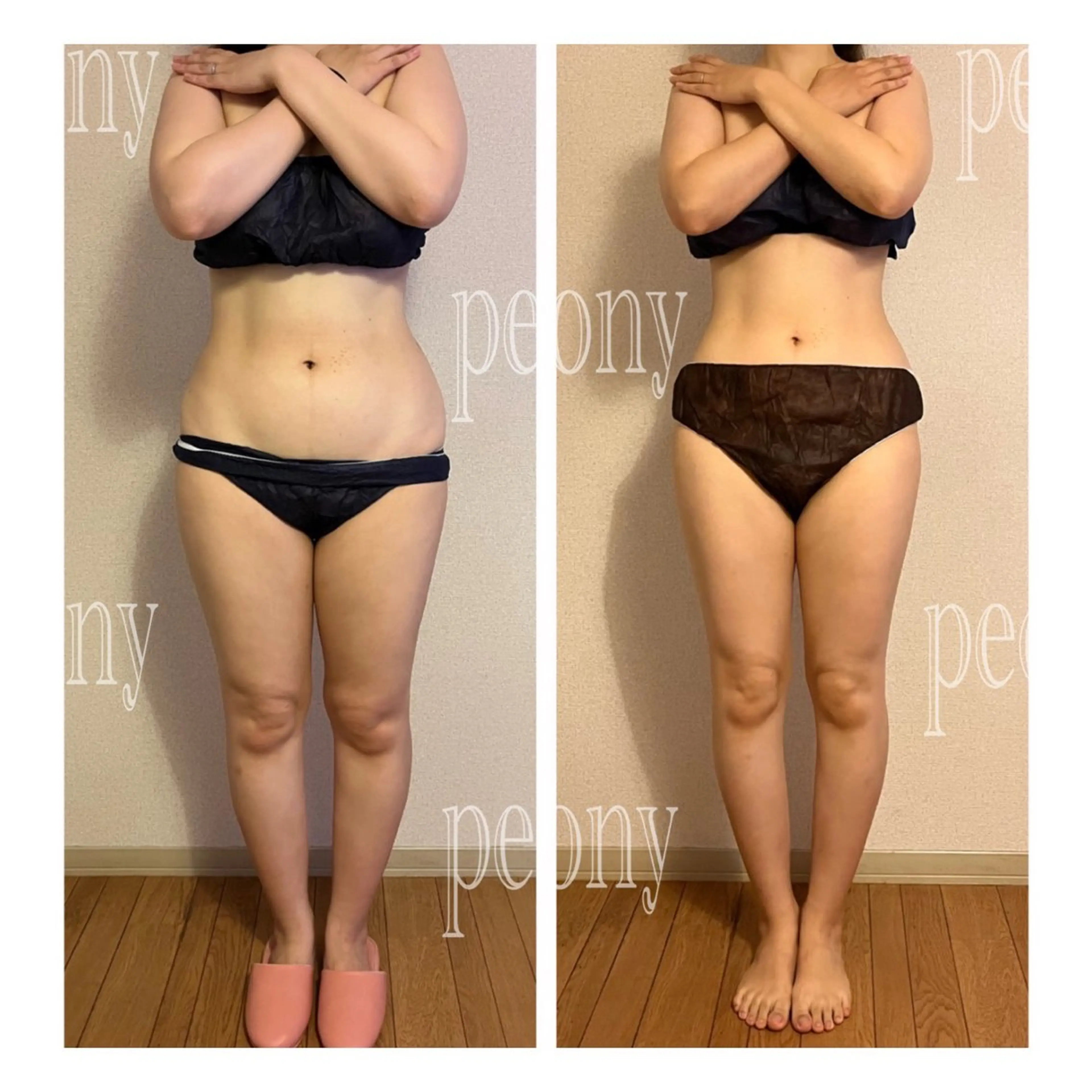 デトックス美容専門サロンｐｅｏｎｙ所属・デトックス美容専門 サロンｐｅｏｎｙのエステ・リラクイメージ