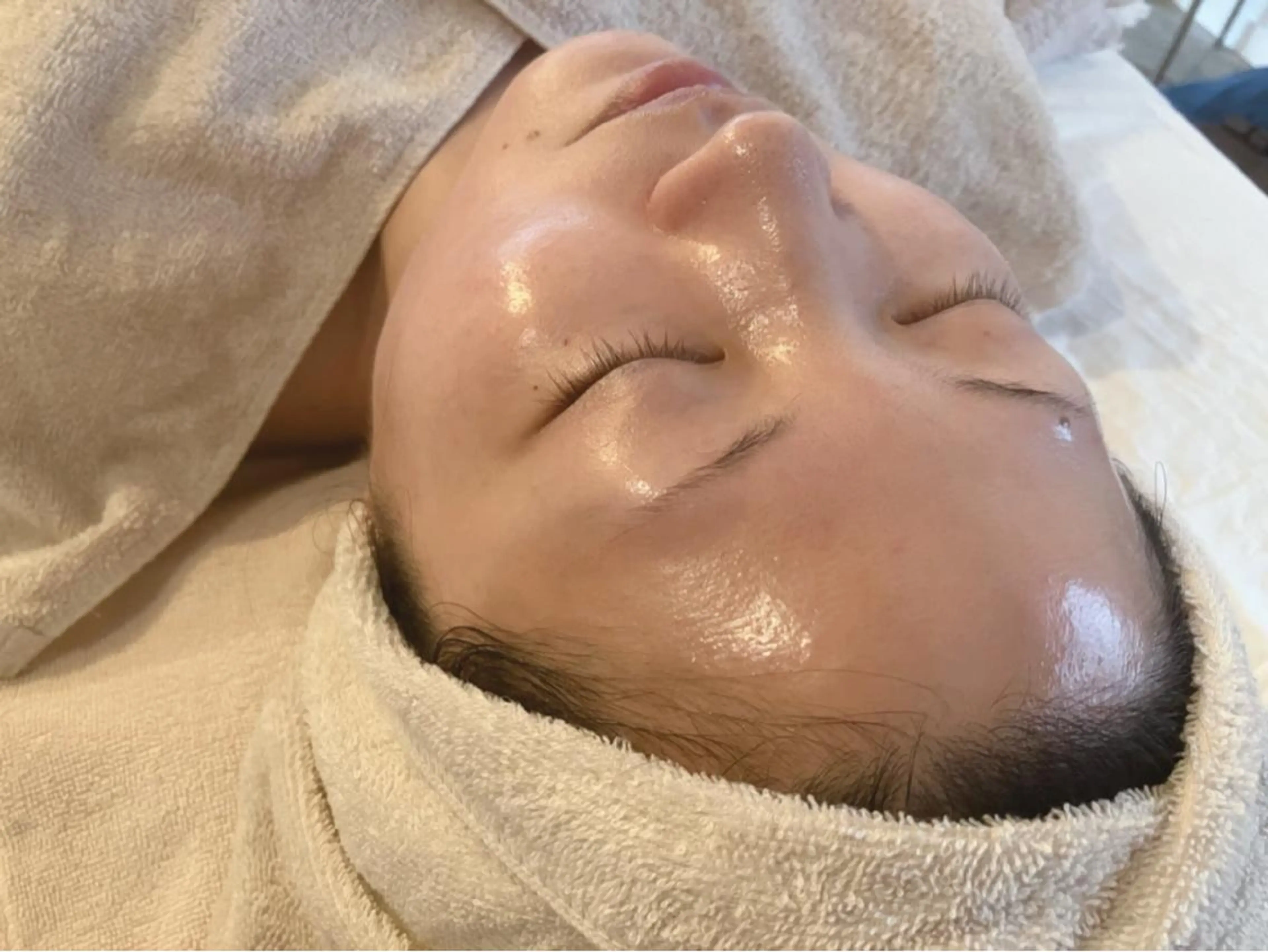 角質ピーリングフェイシャル【50分】の写真