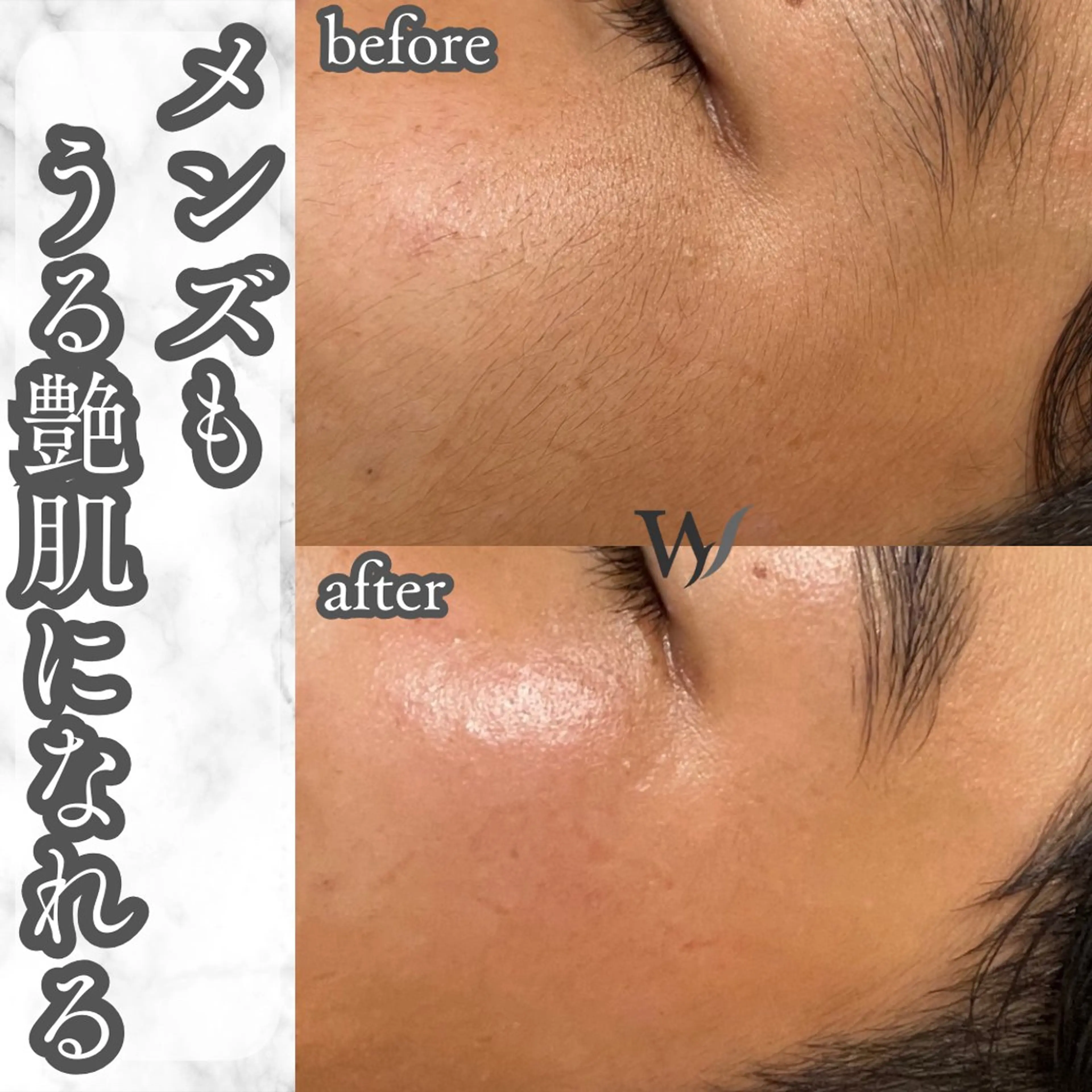 メンズ 脱毛 ホワイトワックス名古屋金山店所属・ホワイトワックス 金山店のエステ・リラクイメージ