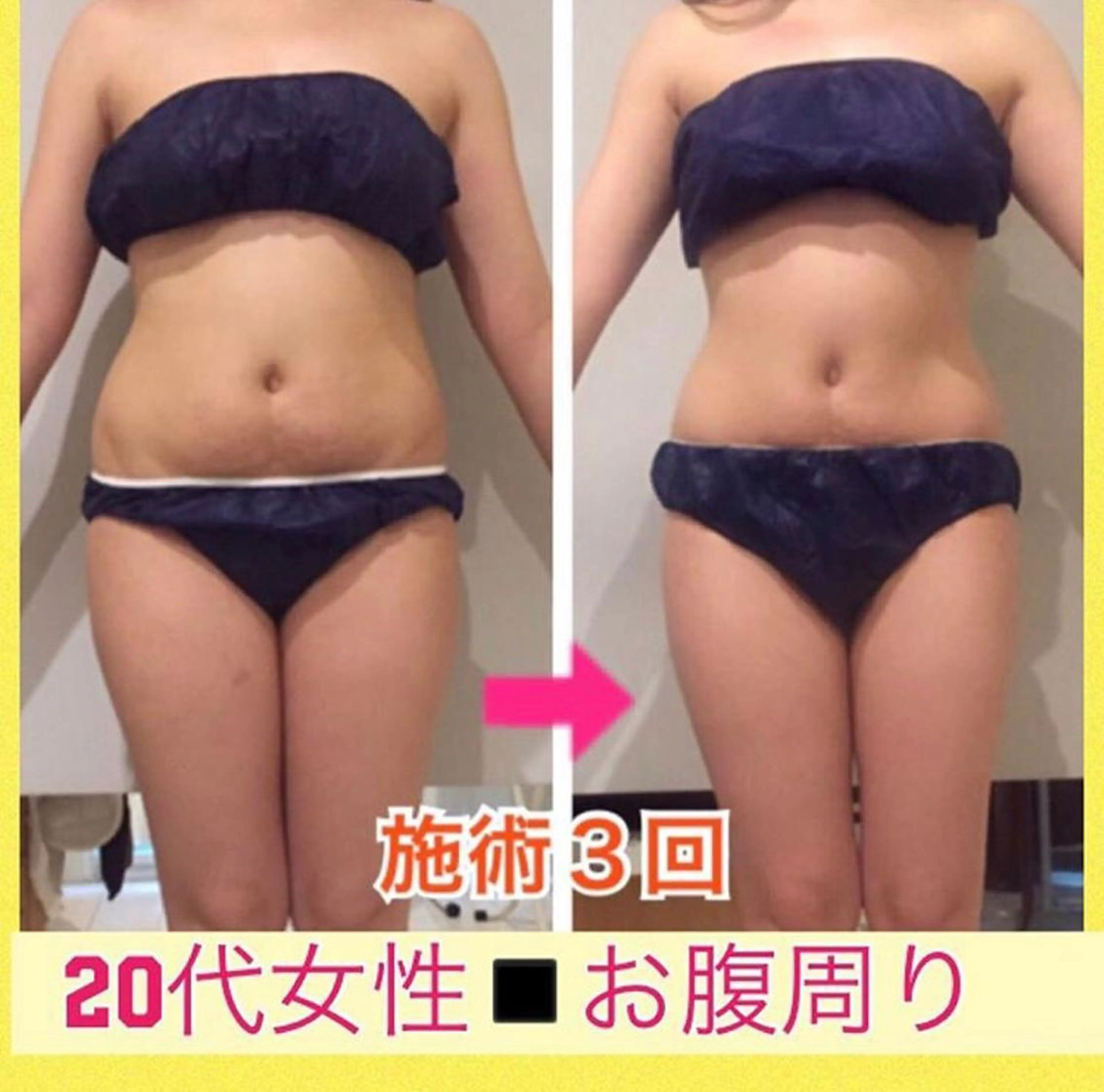 ロング カラー パーマ ヘアアレンジ メンズ キッズ ネイル マツエク・マツパ ‍痩身＆ボディ 結果出し🌟丹野のエステ・リラクイメージ