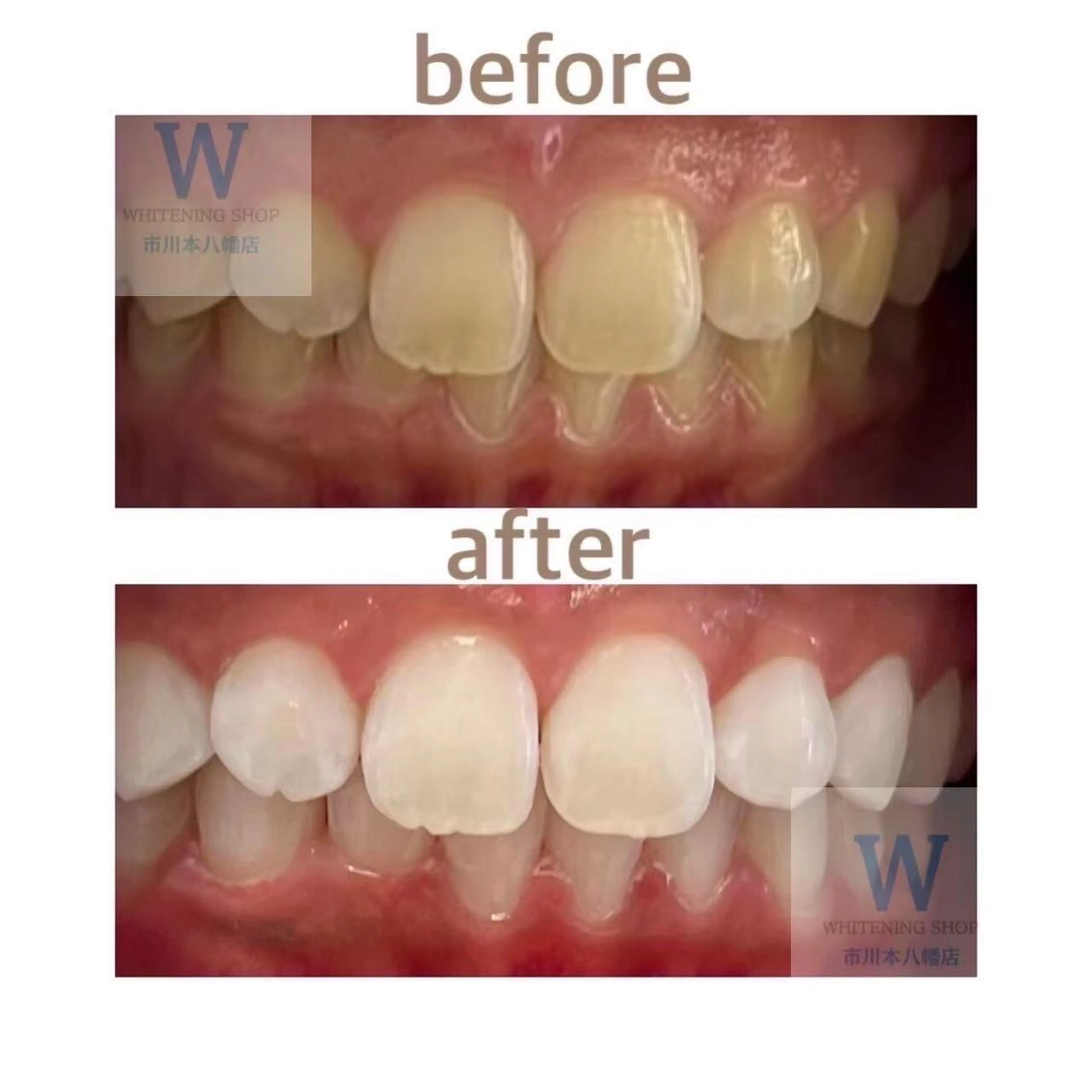 ホワイトニング ショップ本八幡店のエステ・リラクイメージ