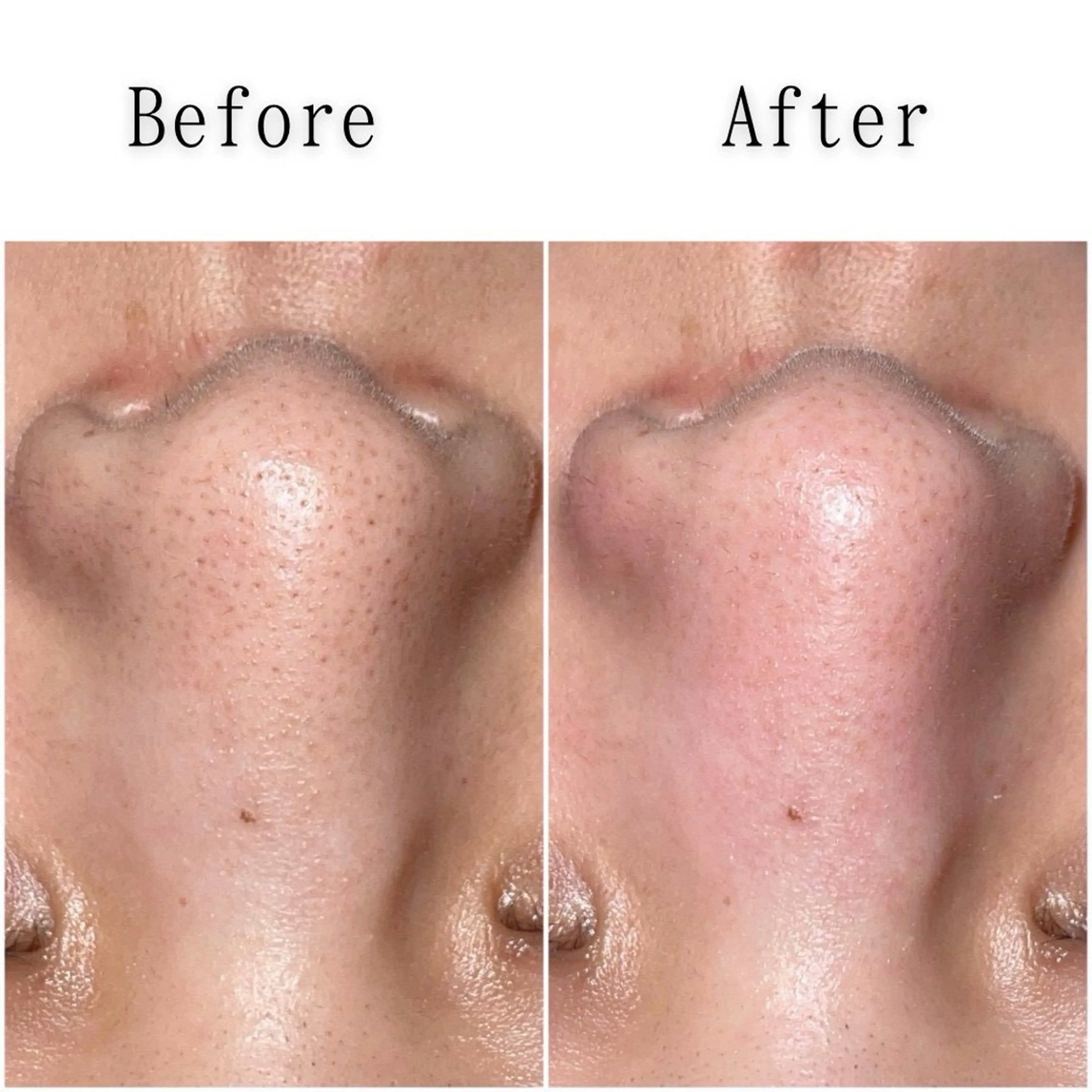 エステ 上西 こころのエステ・リラクイメージ