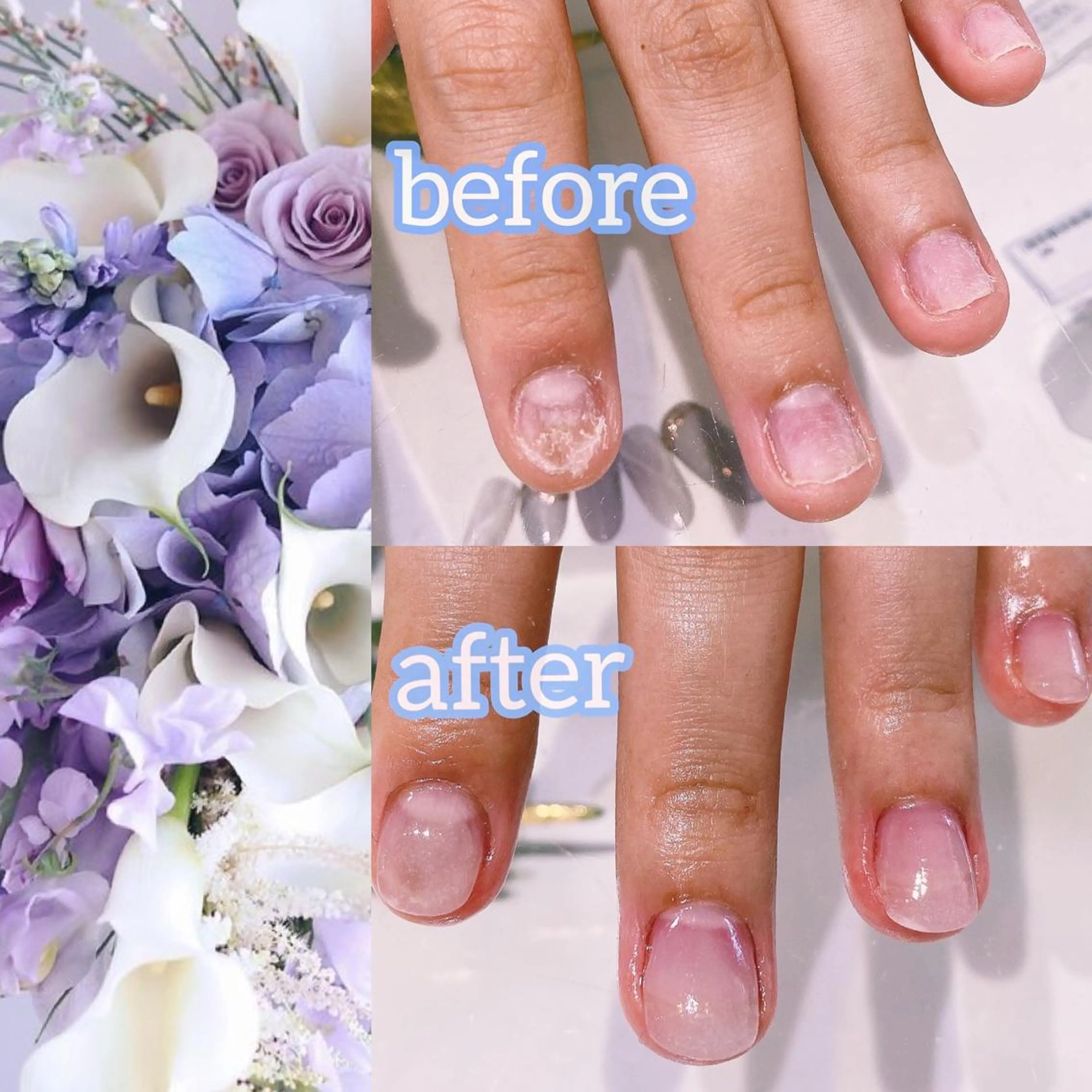 ネイル ハンドネイル Nail×Lani 深爪矯正対応◎のネイルデザイン