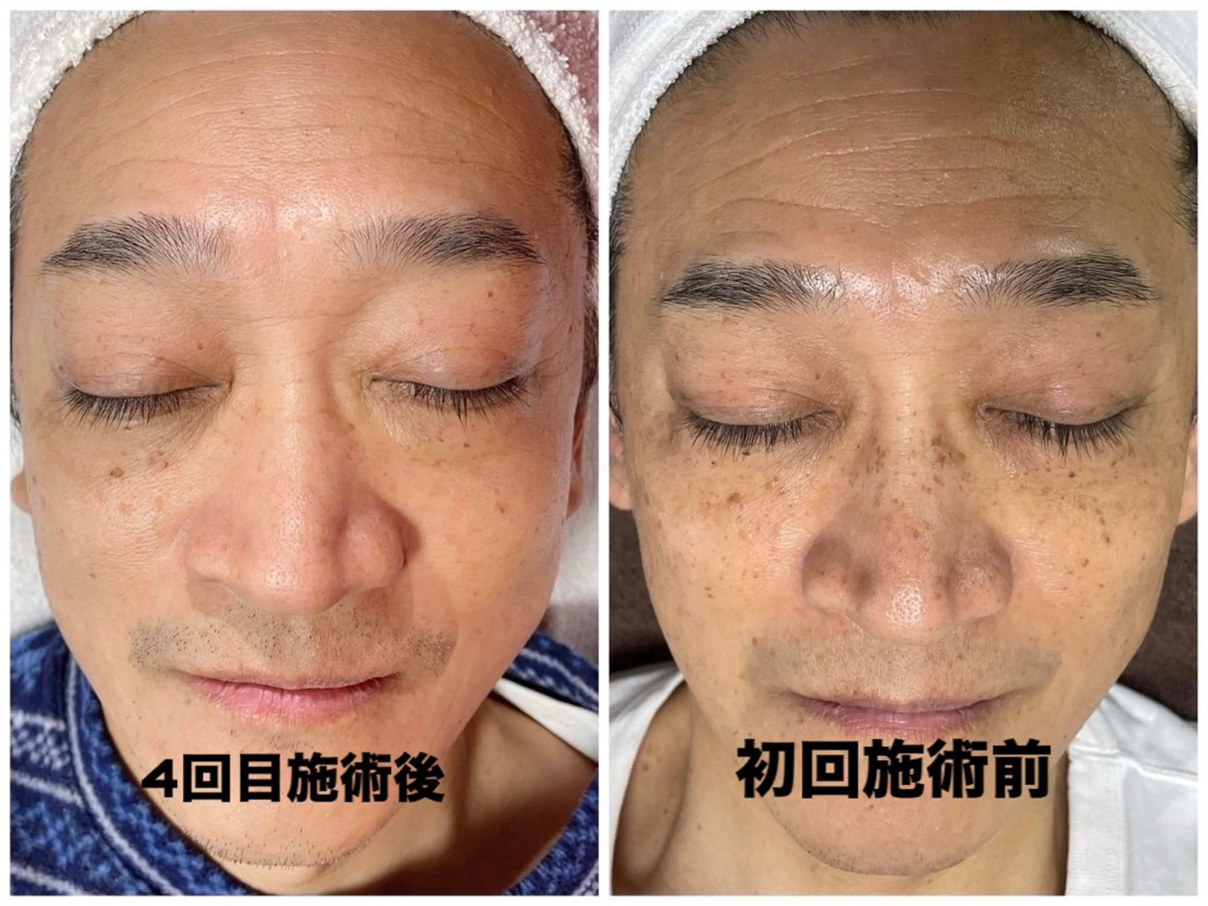 エステ スリーエスプラス内　美肌サロンEme所属・希映 -kieのエステ・リラクイメージ