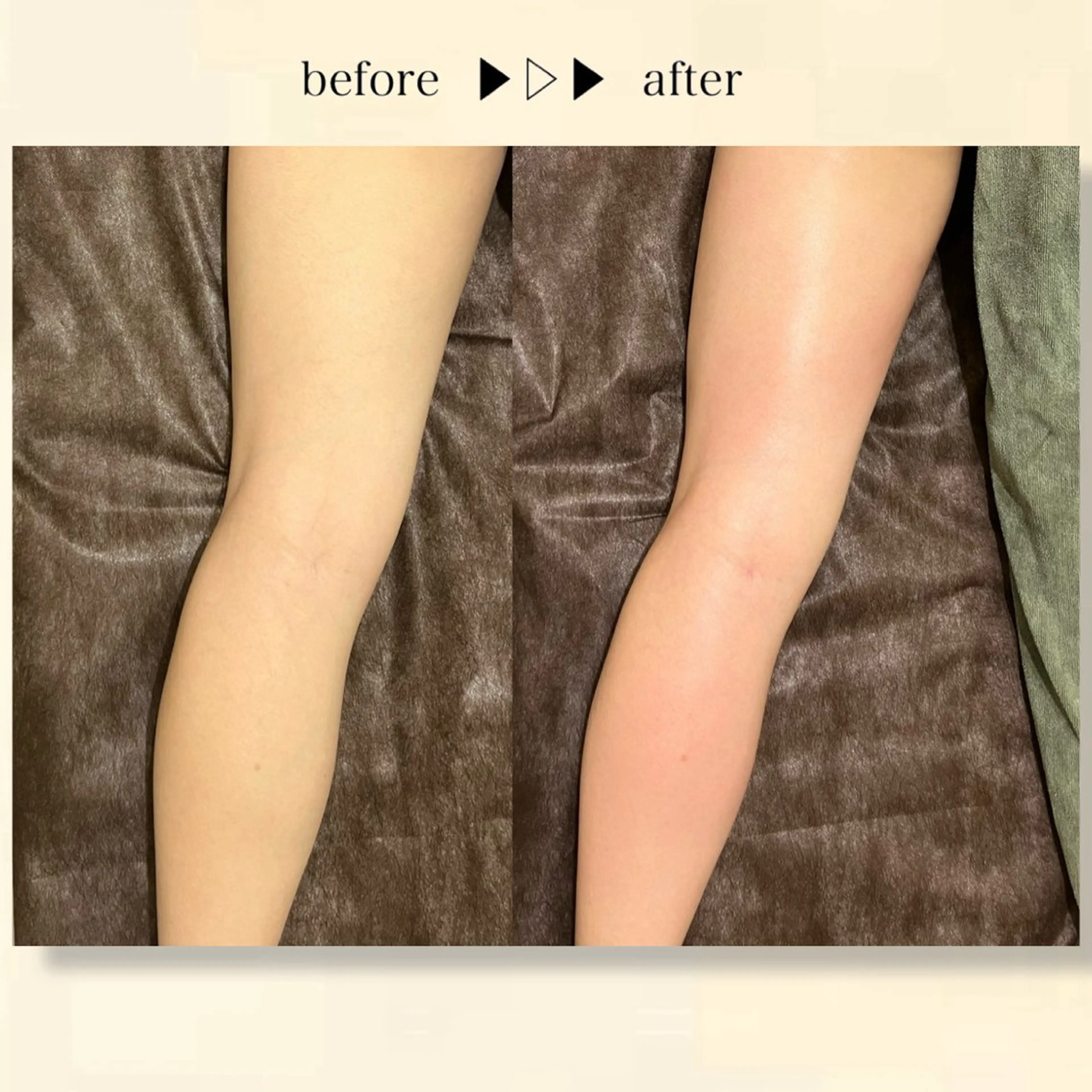 エステ リラク ☆痩身/小顔☆ コルギのエステ・リラクイメージ