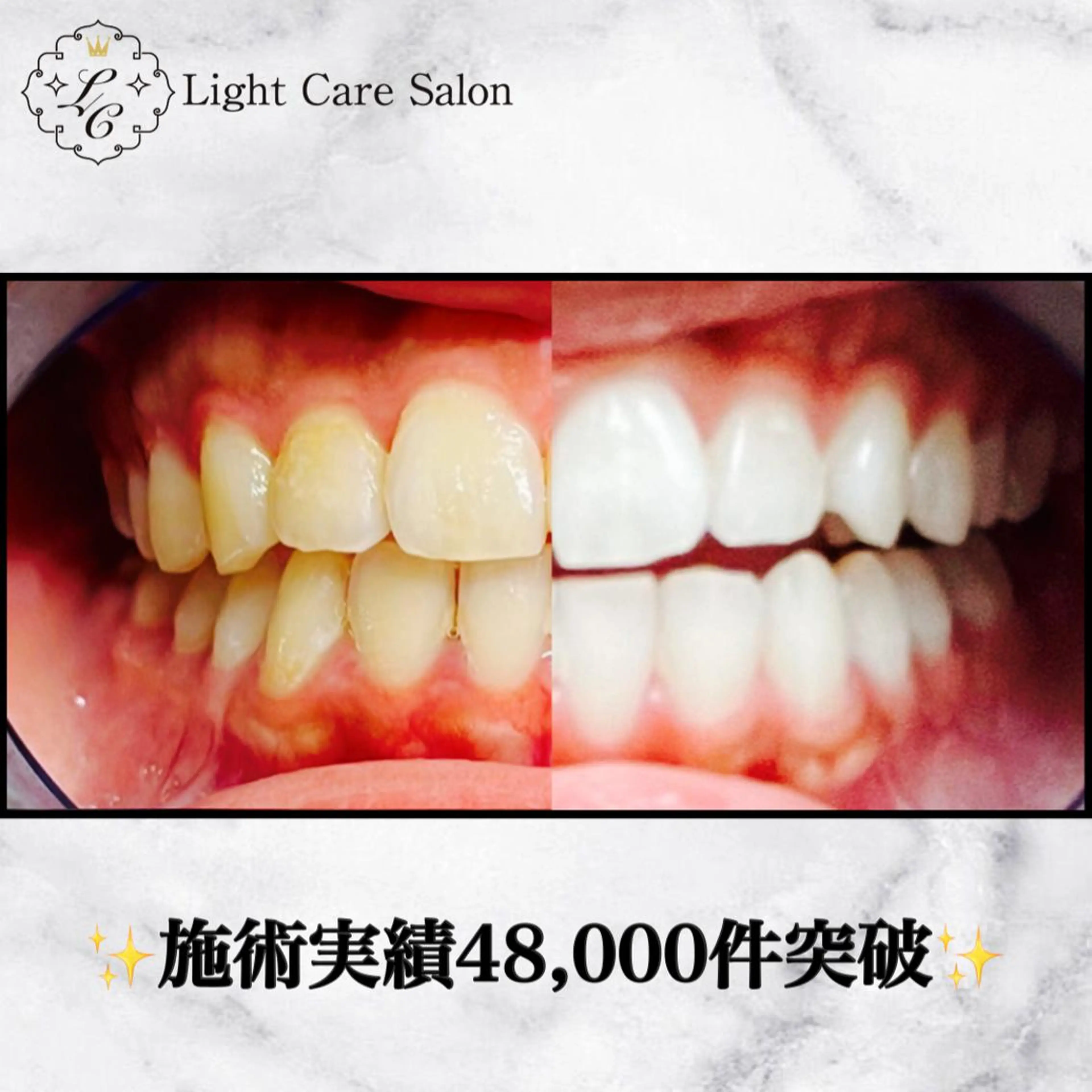 ホワイトニング専門店 LCS 銀座店 峰岡のその他イメージ