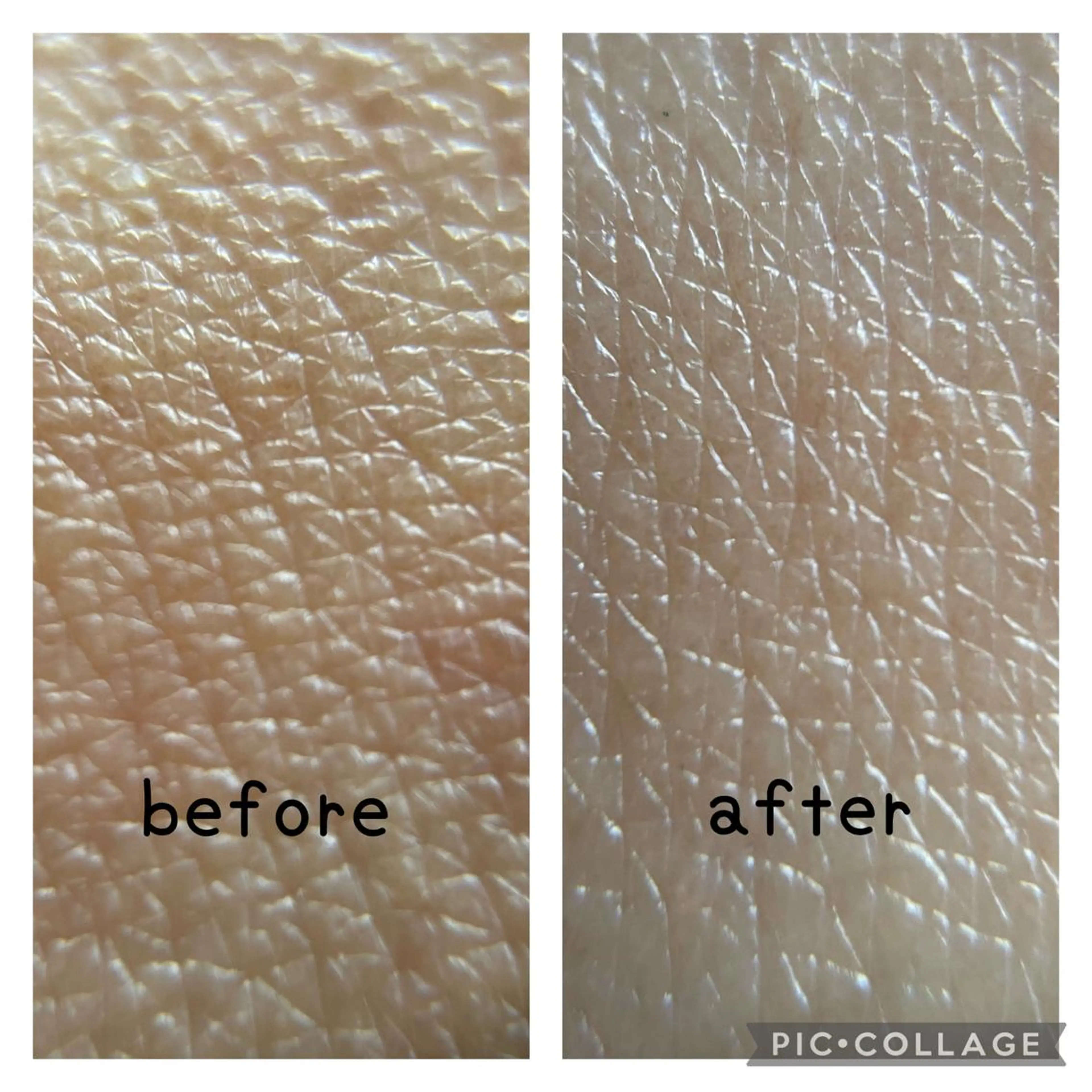 grow所属・Yoshino Erinaのエステ・リラクイメージ