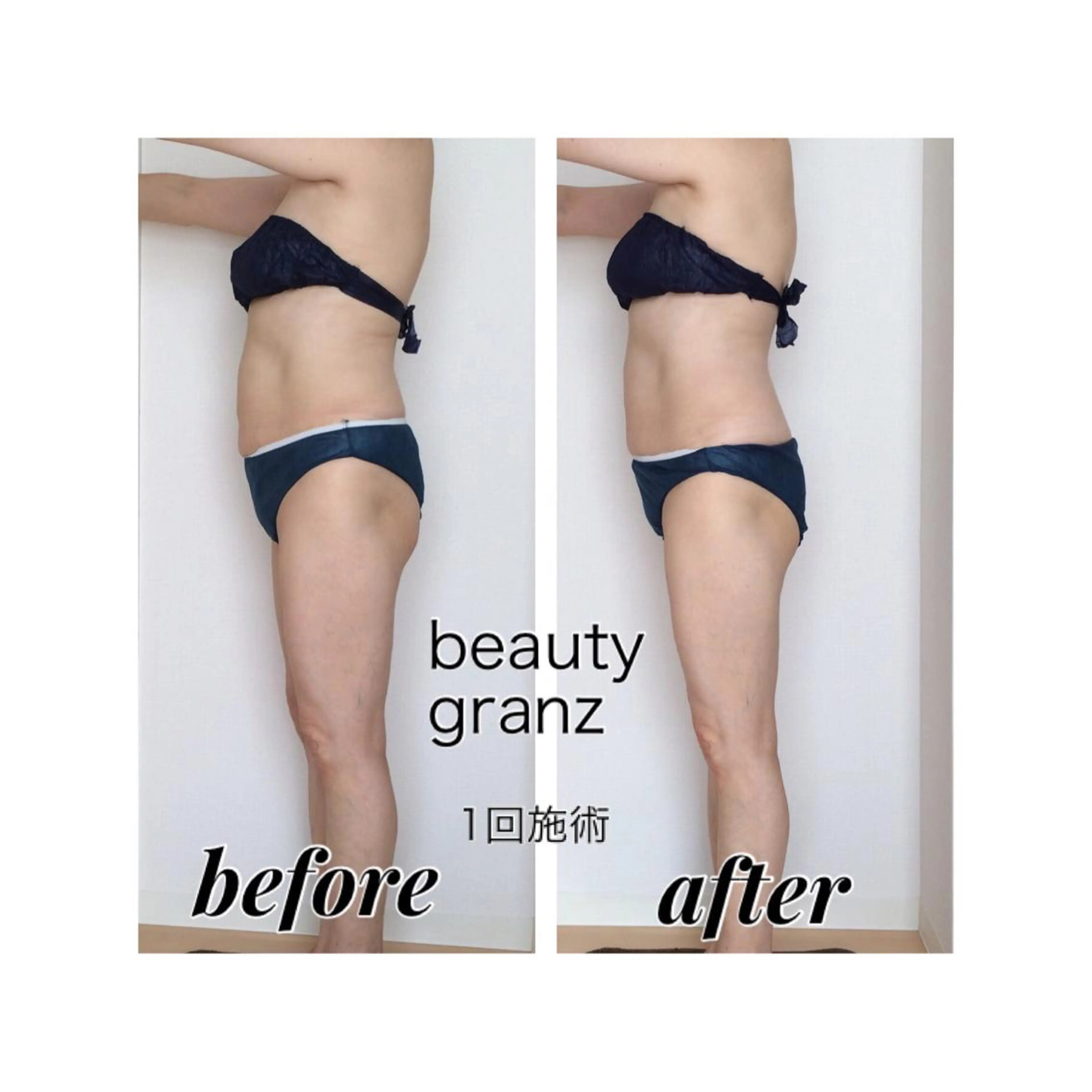 痩身専門サロン ビューティーグランツのエステ・リラクイメージ