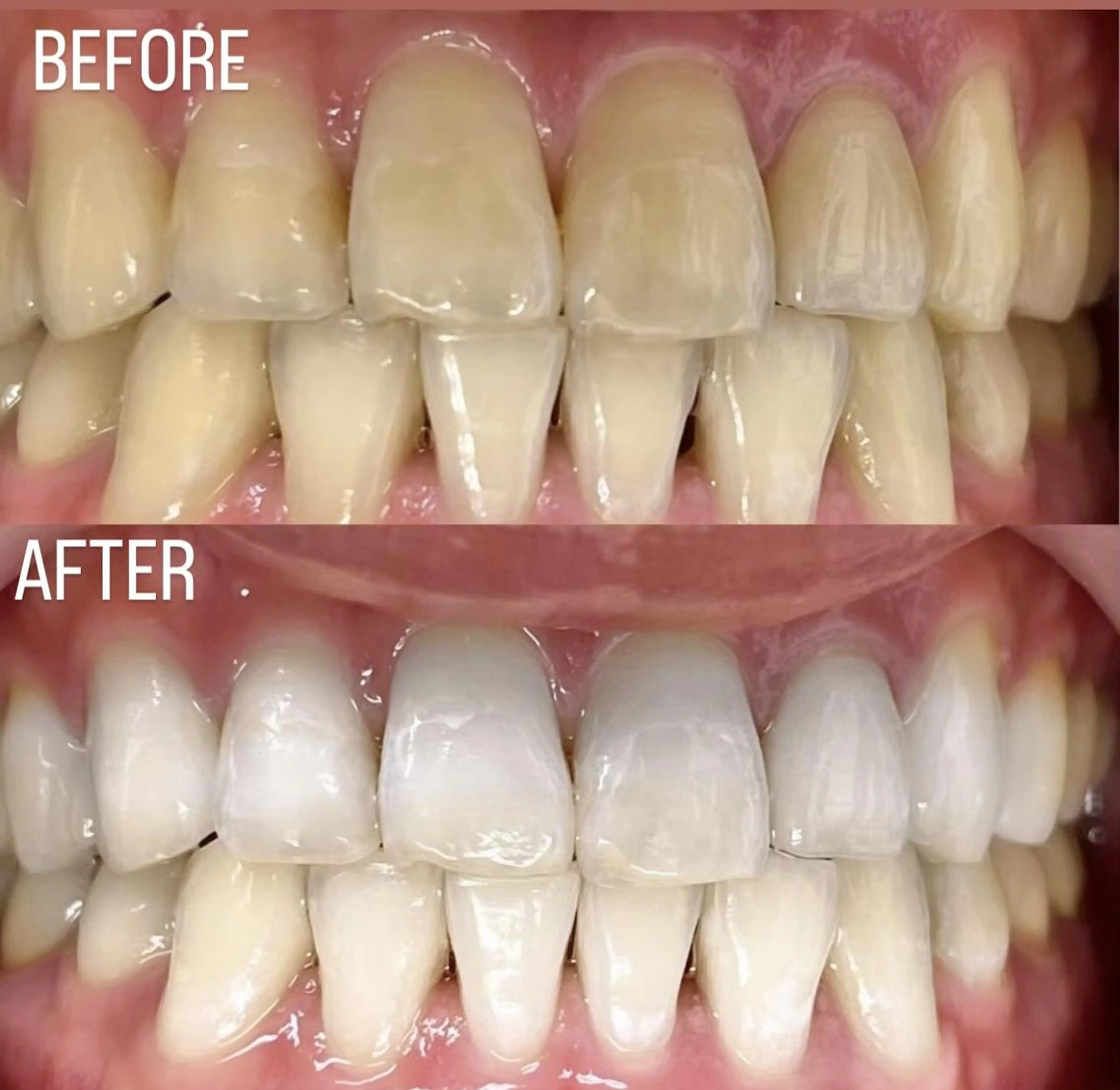 LBSホワイトニング 銀座店💎公式のその他イメージ