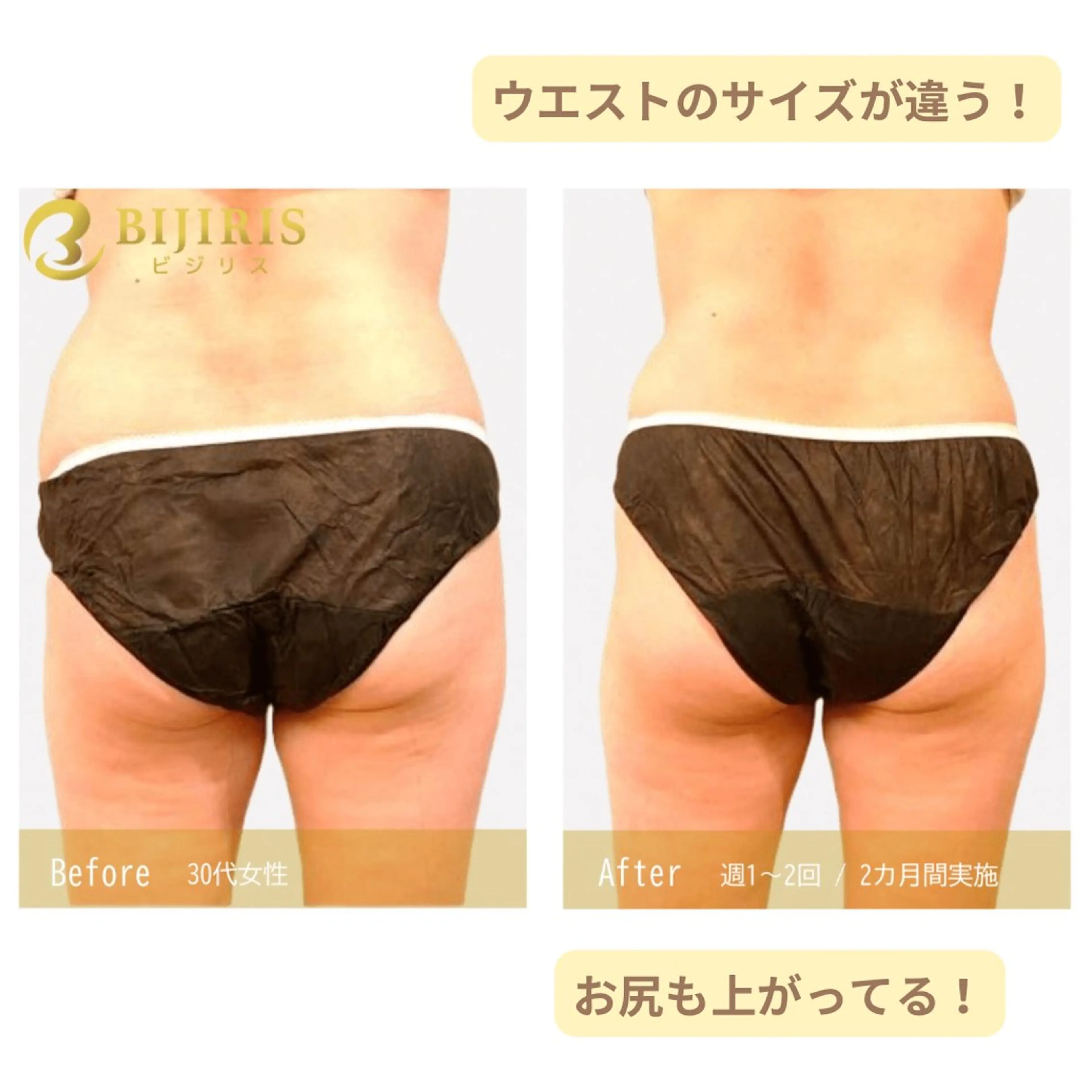 セルフ脱毛/美尻イス キングスサロン熊本のエステ・リラクイメージ