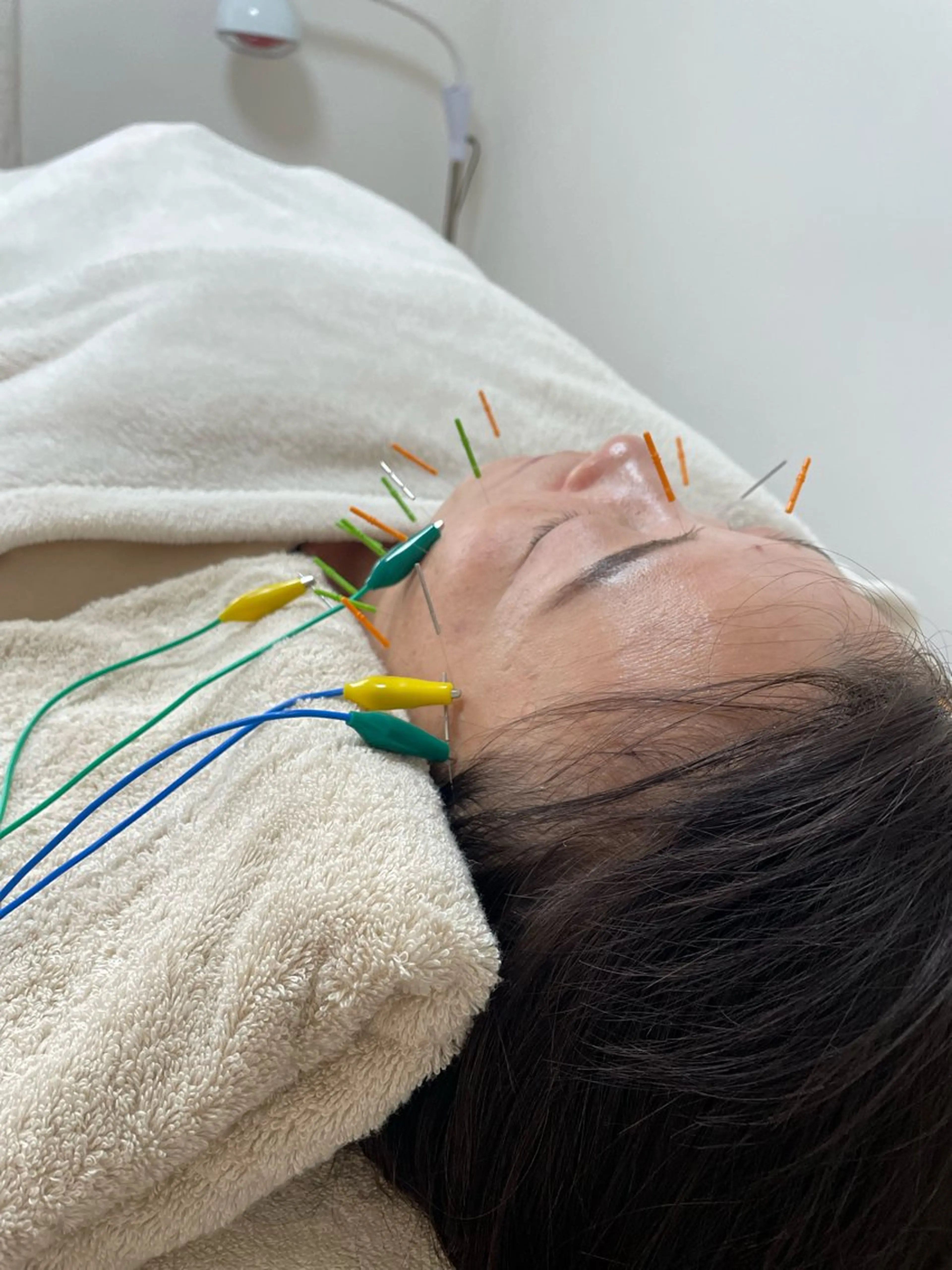 美容鍼灸サロン   colorier所属・美容鍼灸サロン colorierのエステ・リラクイメージ