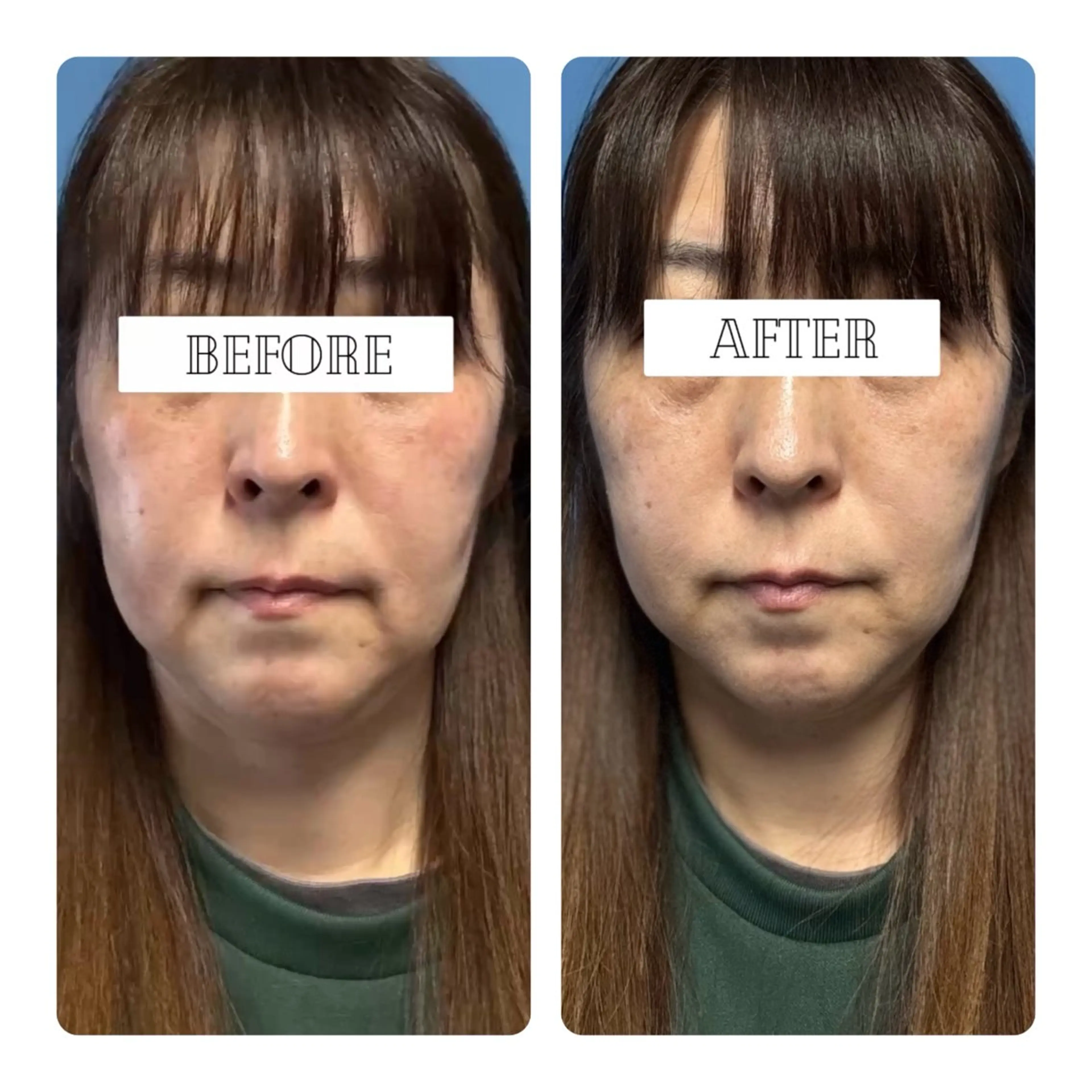 Leisurely レイジュアリーのエステ・リラクイメージ