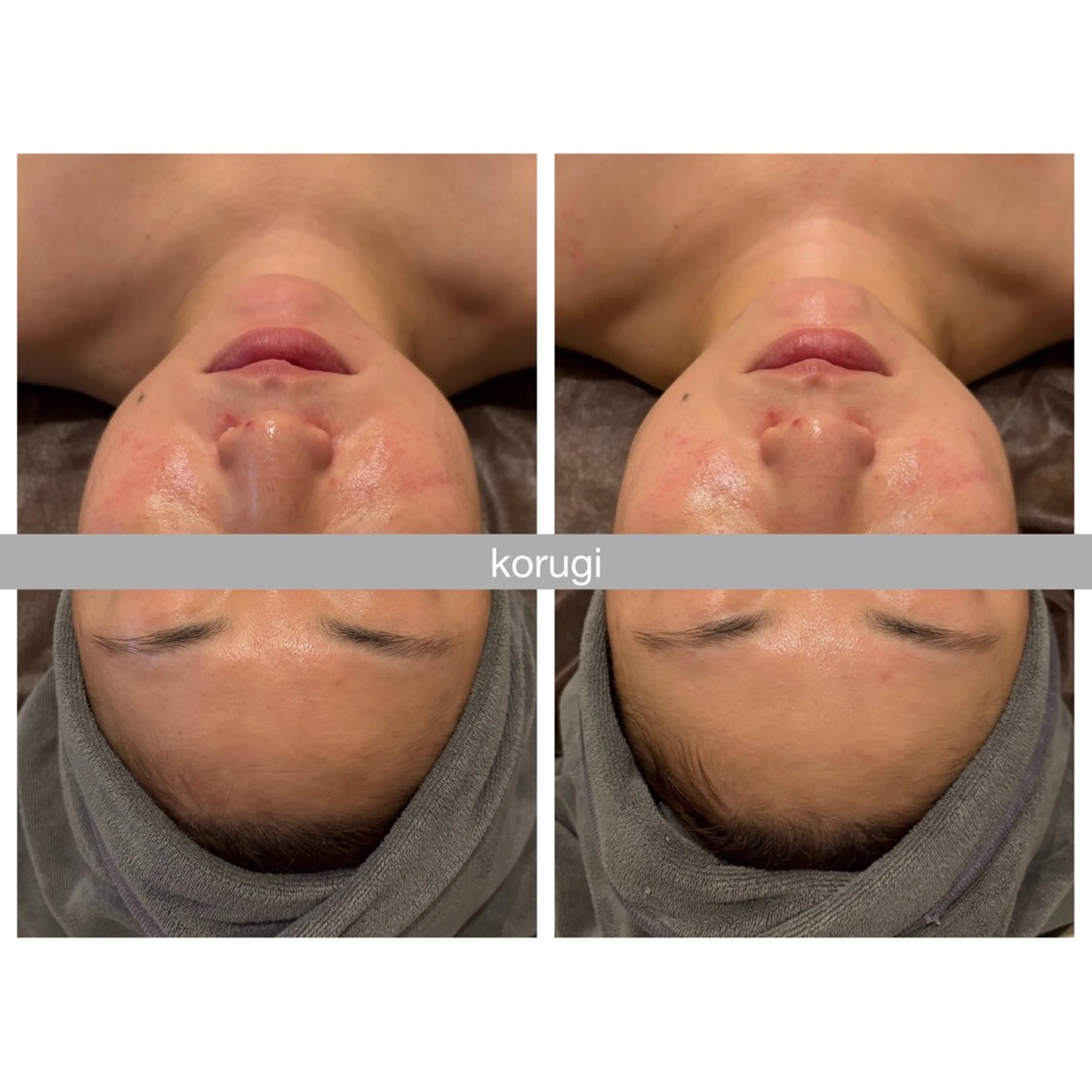 ☆痩身/小顔☆ 結果出します☆のエステ・リラクイメージ