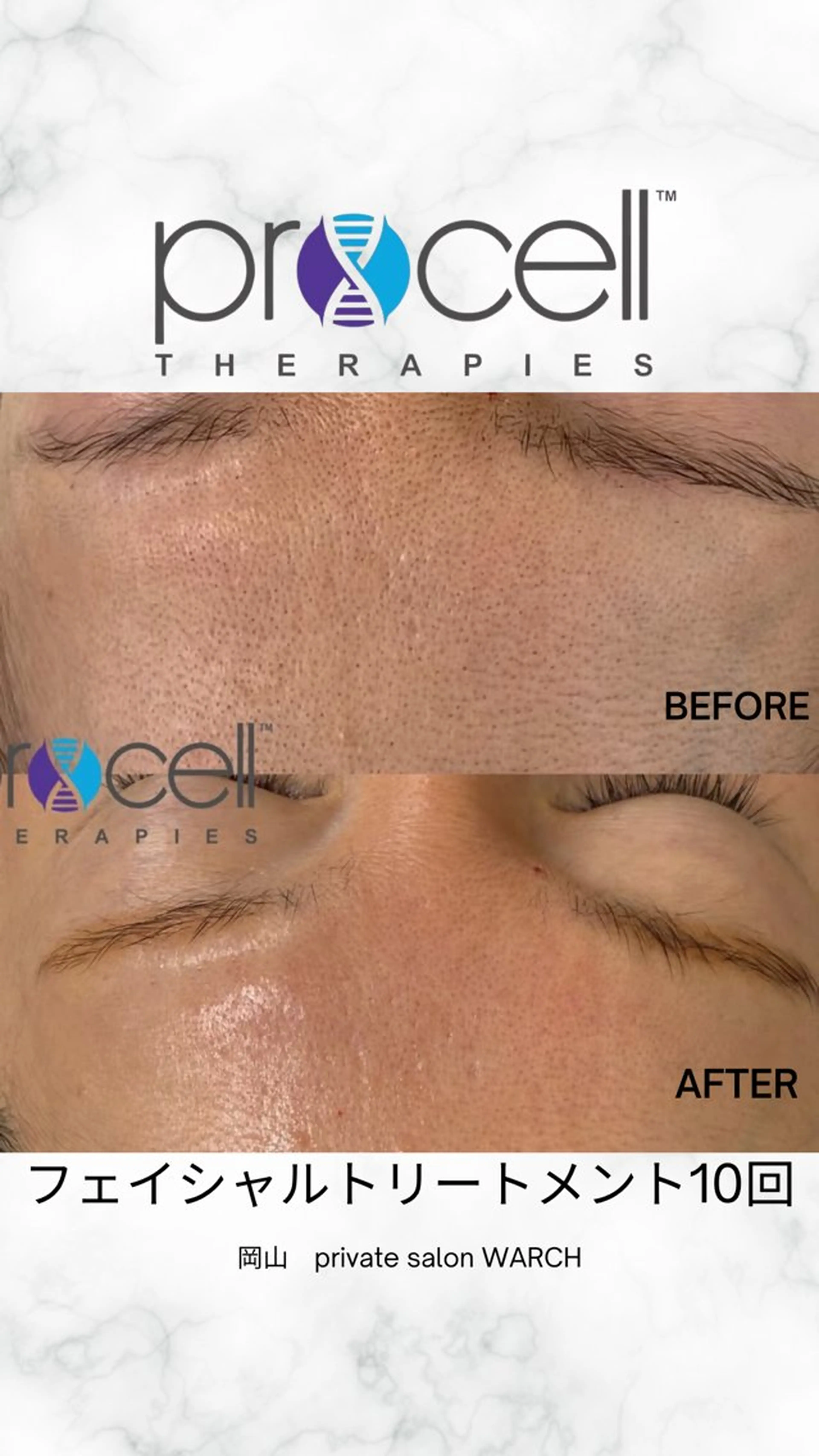 WARCH Marieのその他イメージ