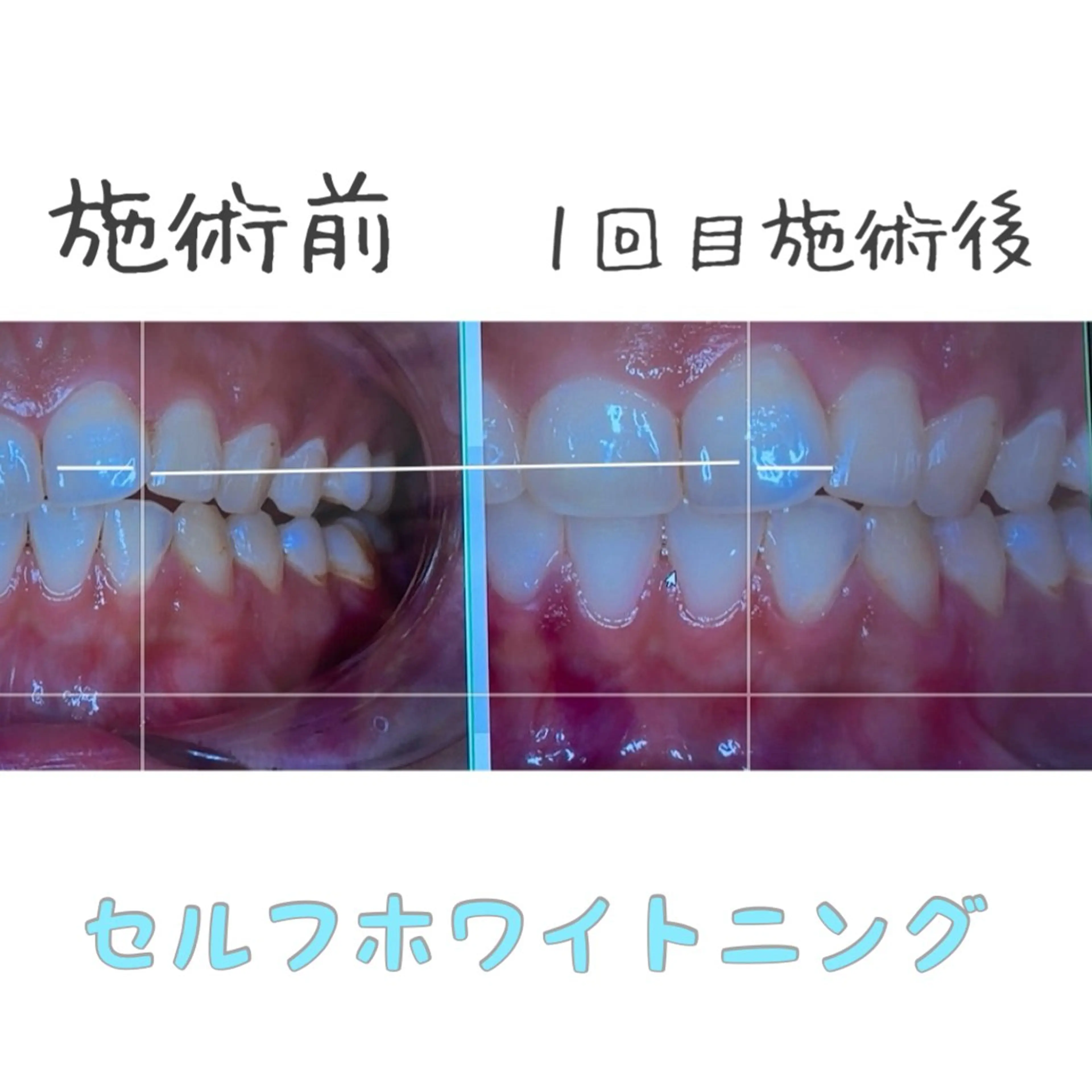 🦋Kiyomi. 🦋のネイルデザイン